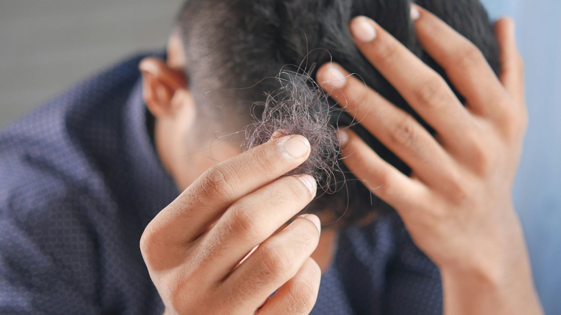 19. Perte de cheveux liée au stress