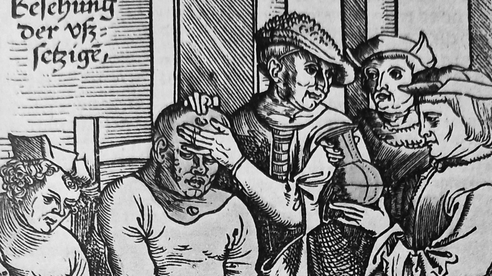 5. Mycobacterium Leprae