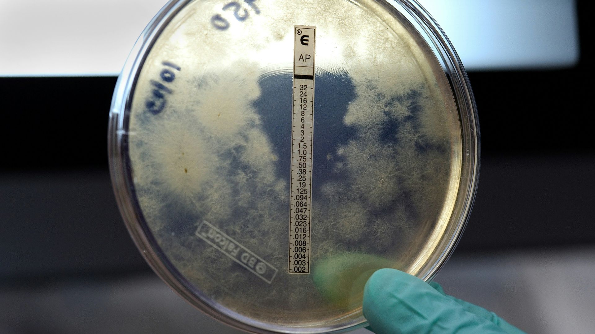 11. Neisseria Meningitidis