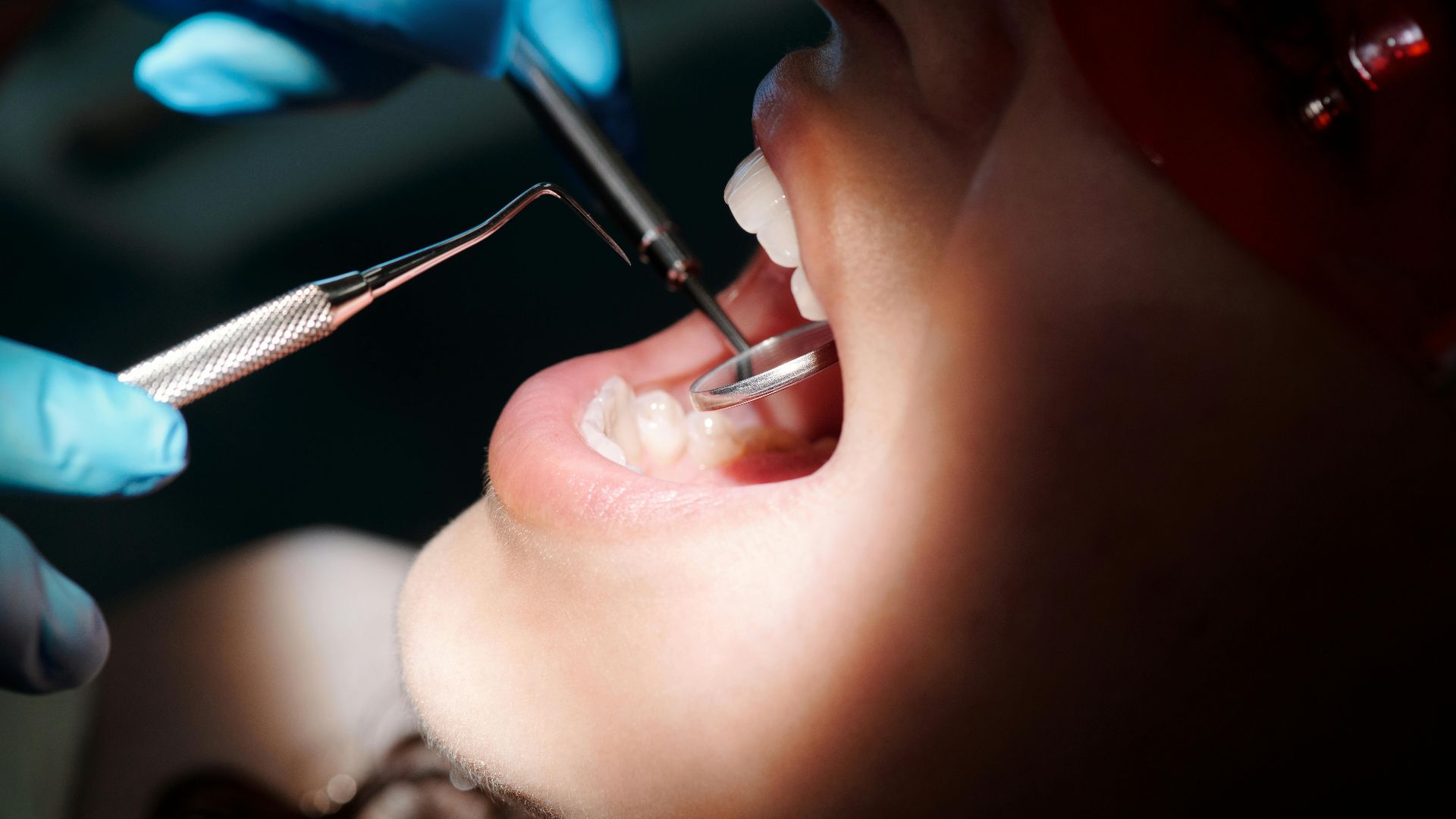 14. La bouche sèche et la récession gingivale deviennent plus fréquentes