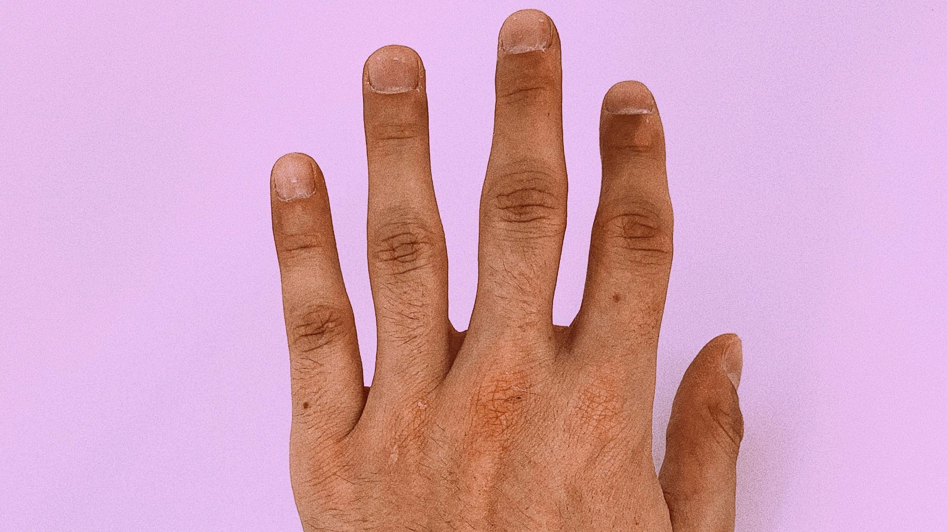 8. Votre peau ne vous démange pas de manière inhabituelle.