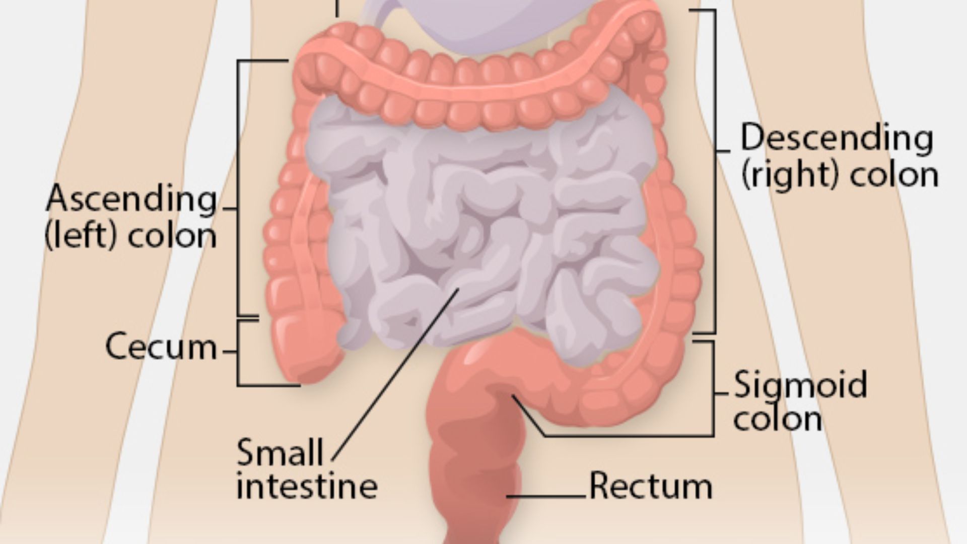 3. Réduction du risque de cancer du côlon