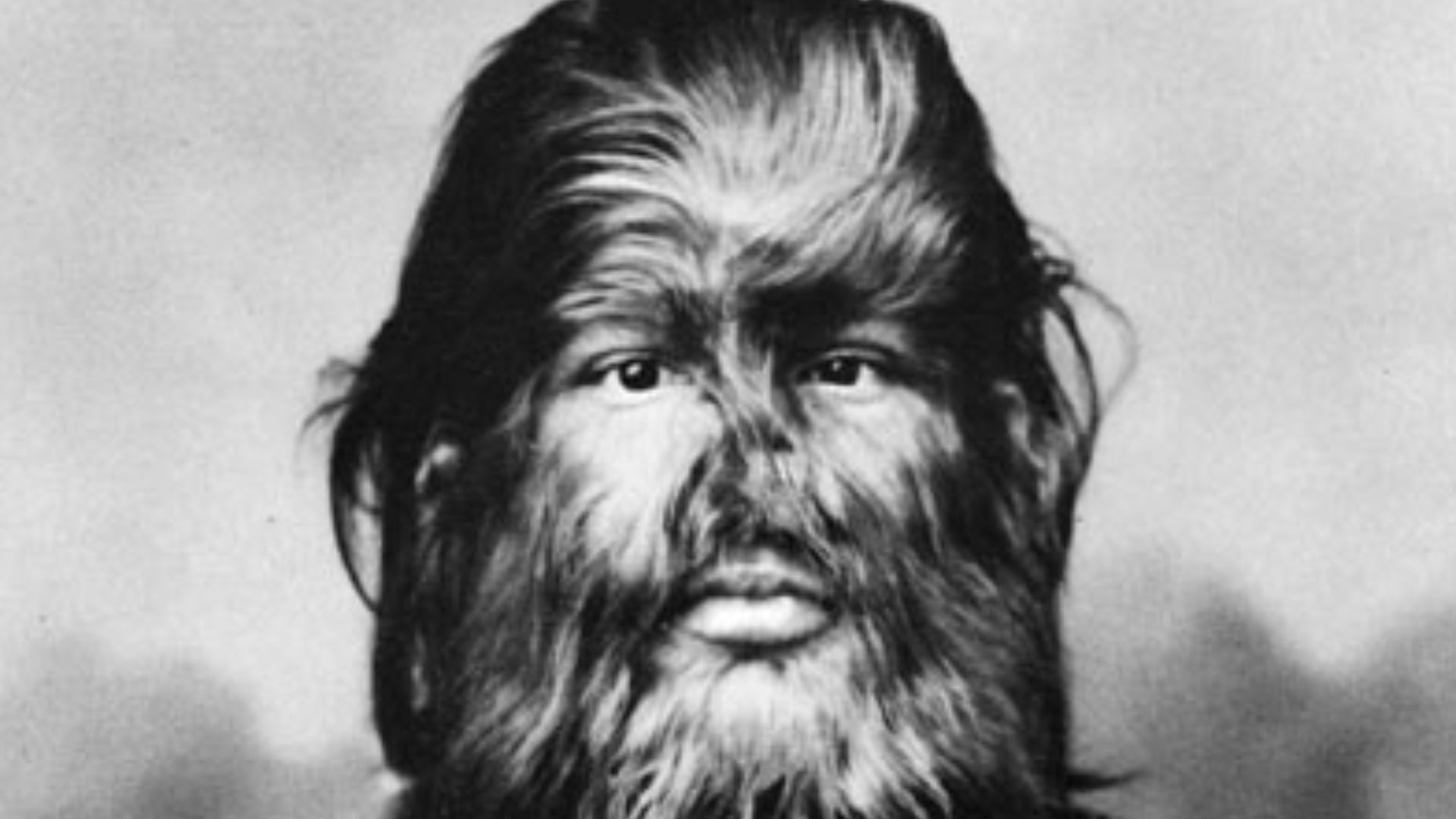 9. Jo-Jo, le garçon au visage de chien