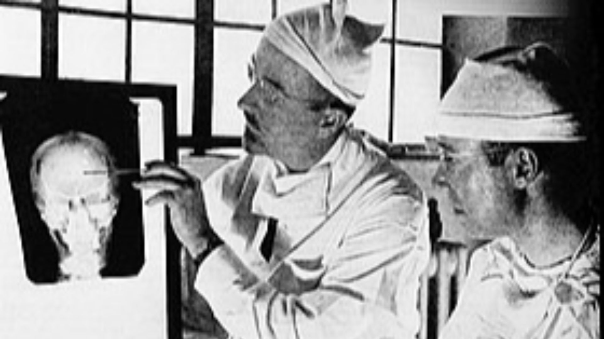 20. La lobotomie était présentée comme un traitement psychiatrique sensé.