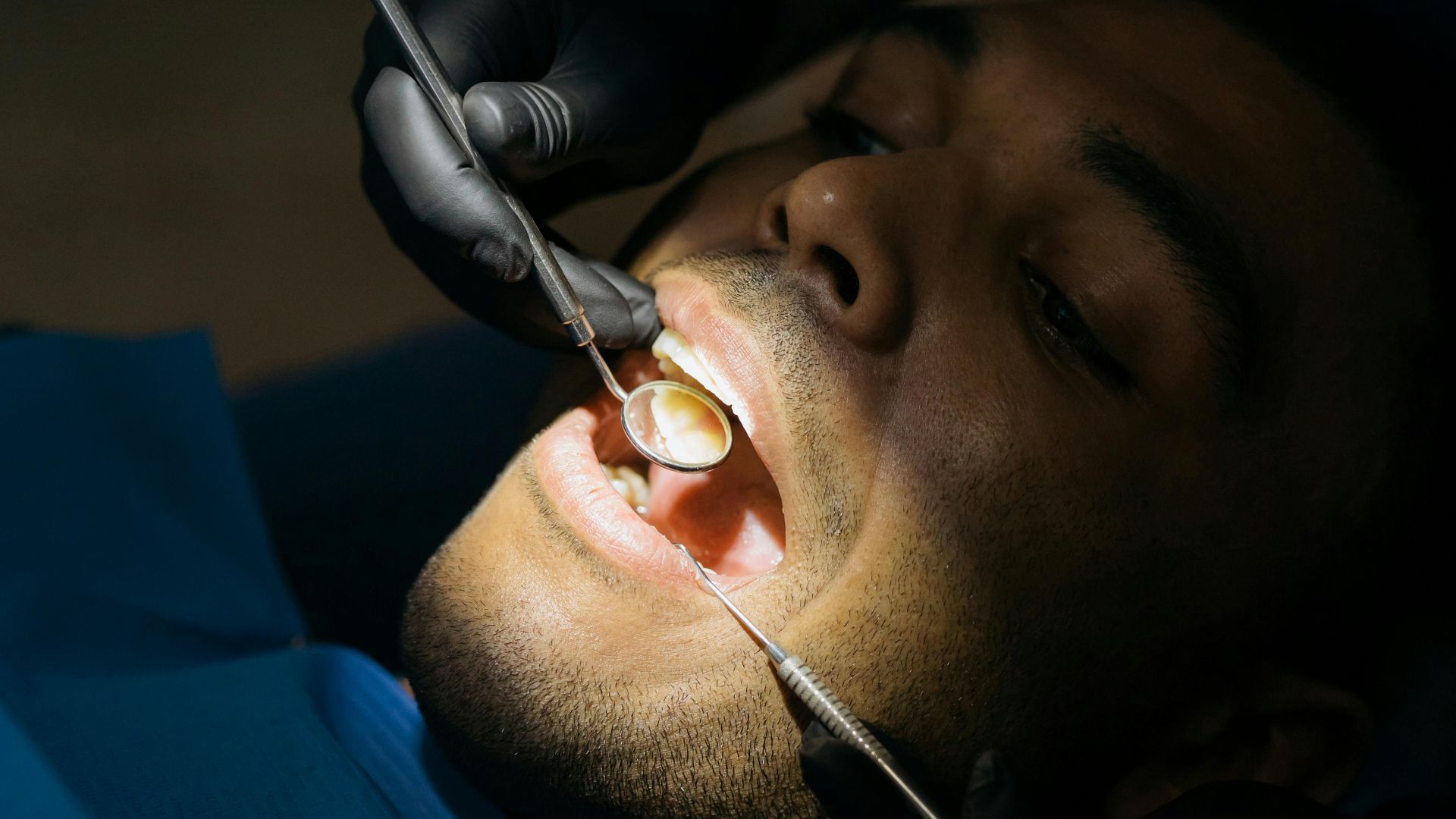 6. Les vers dentaires ont creusé des trous dans les dents