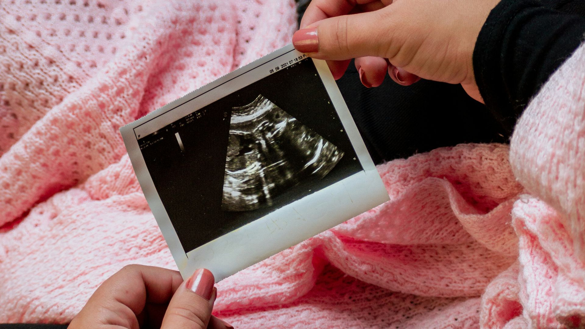 4. Une utérus errant a déclenché la maladie chez les femmes