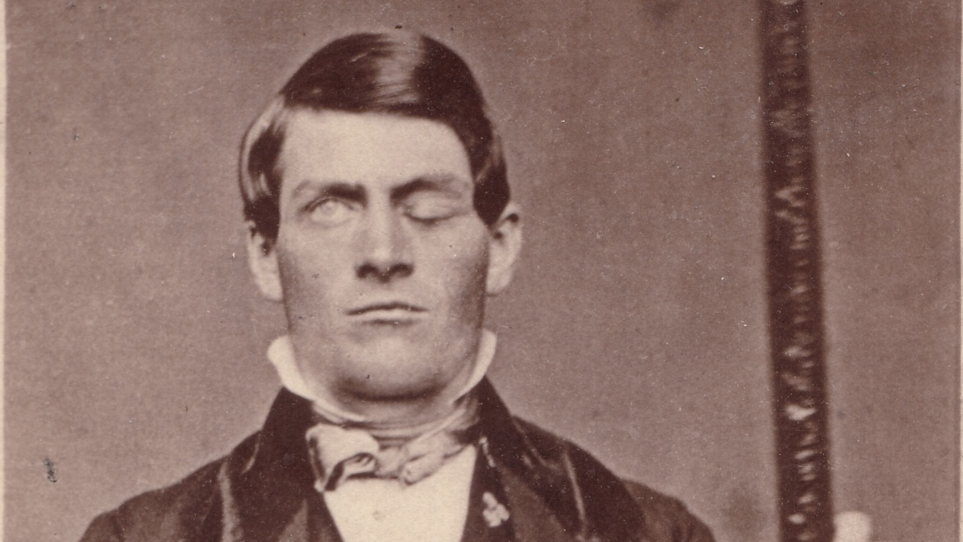 15. Phineas Gage et la barre de fer