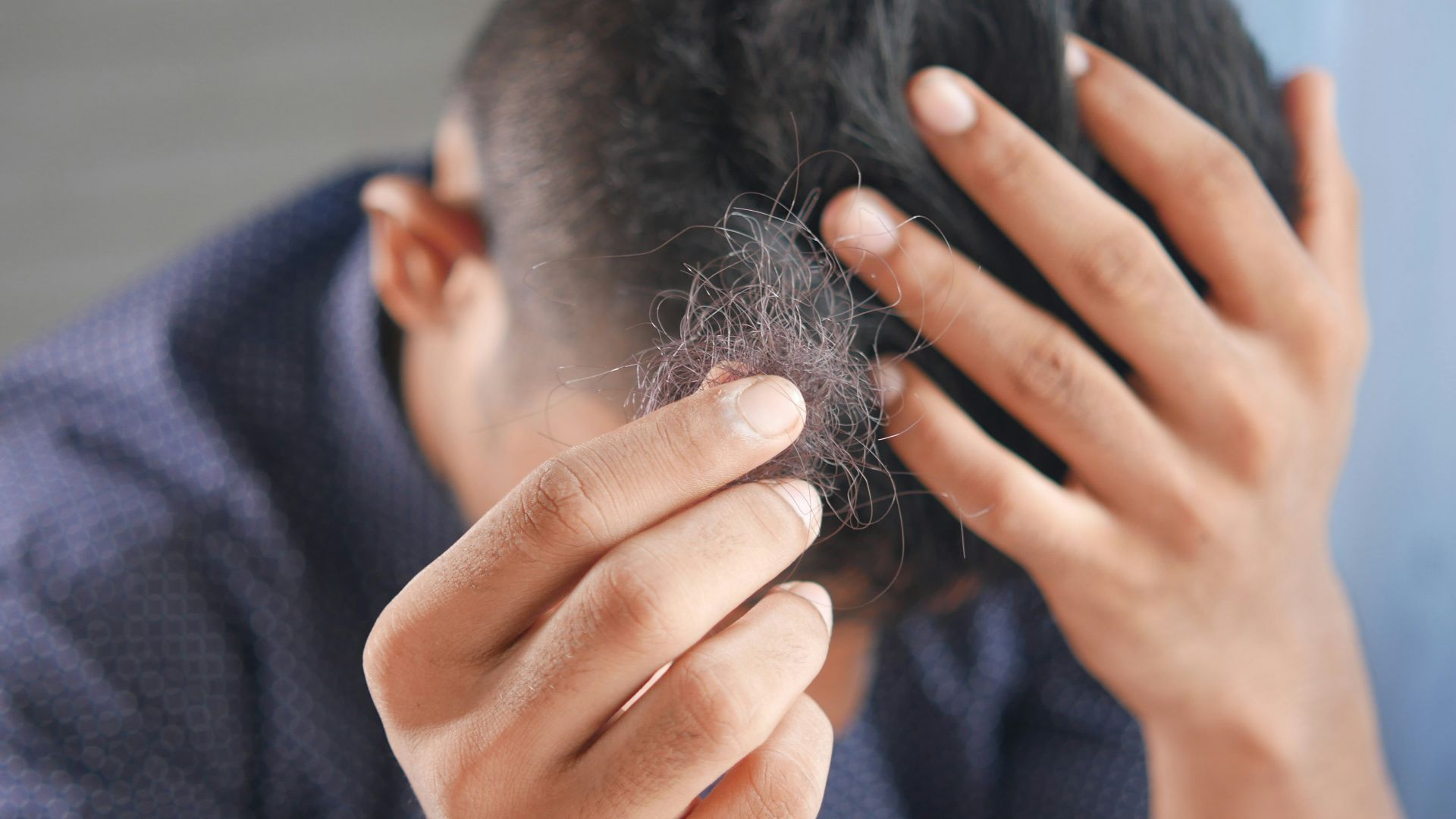 4. Les changements au niveau de la racine des cheveux deviennent difficiles à ignorer