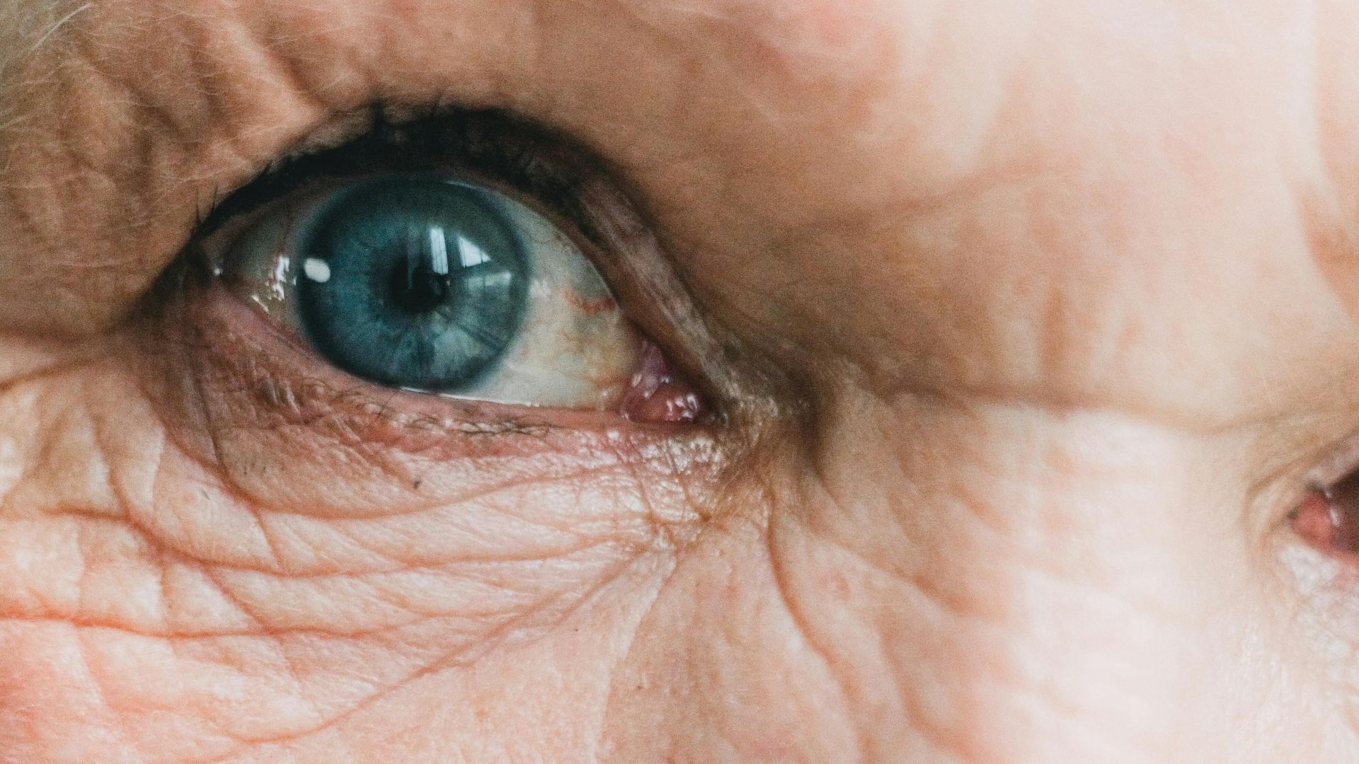4. Une peau qui semble plus sèche
