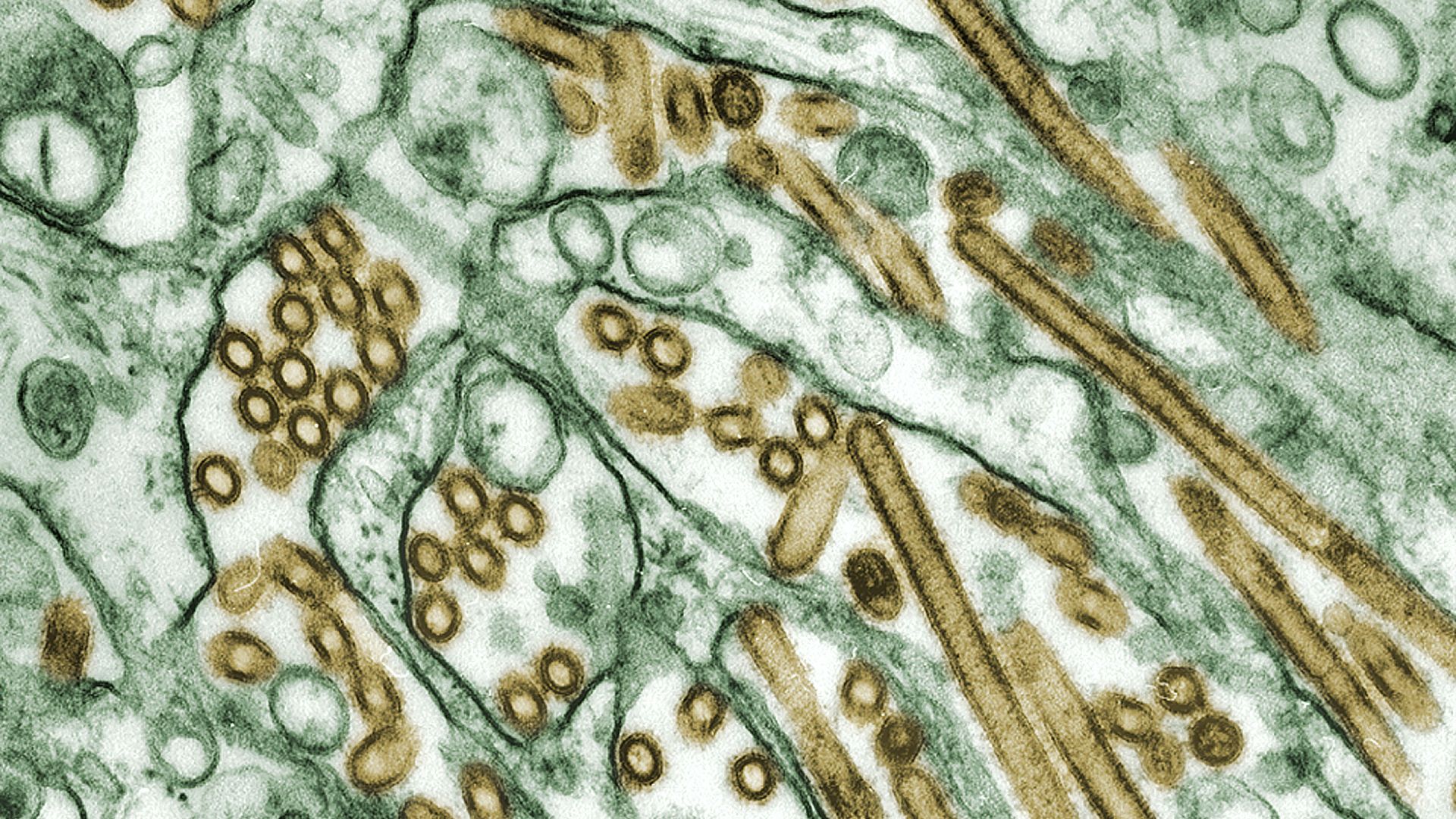 16. Les lentivirus dans l'édition génétique