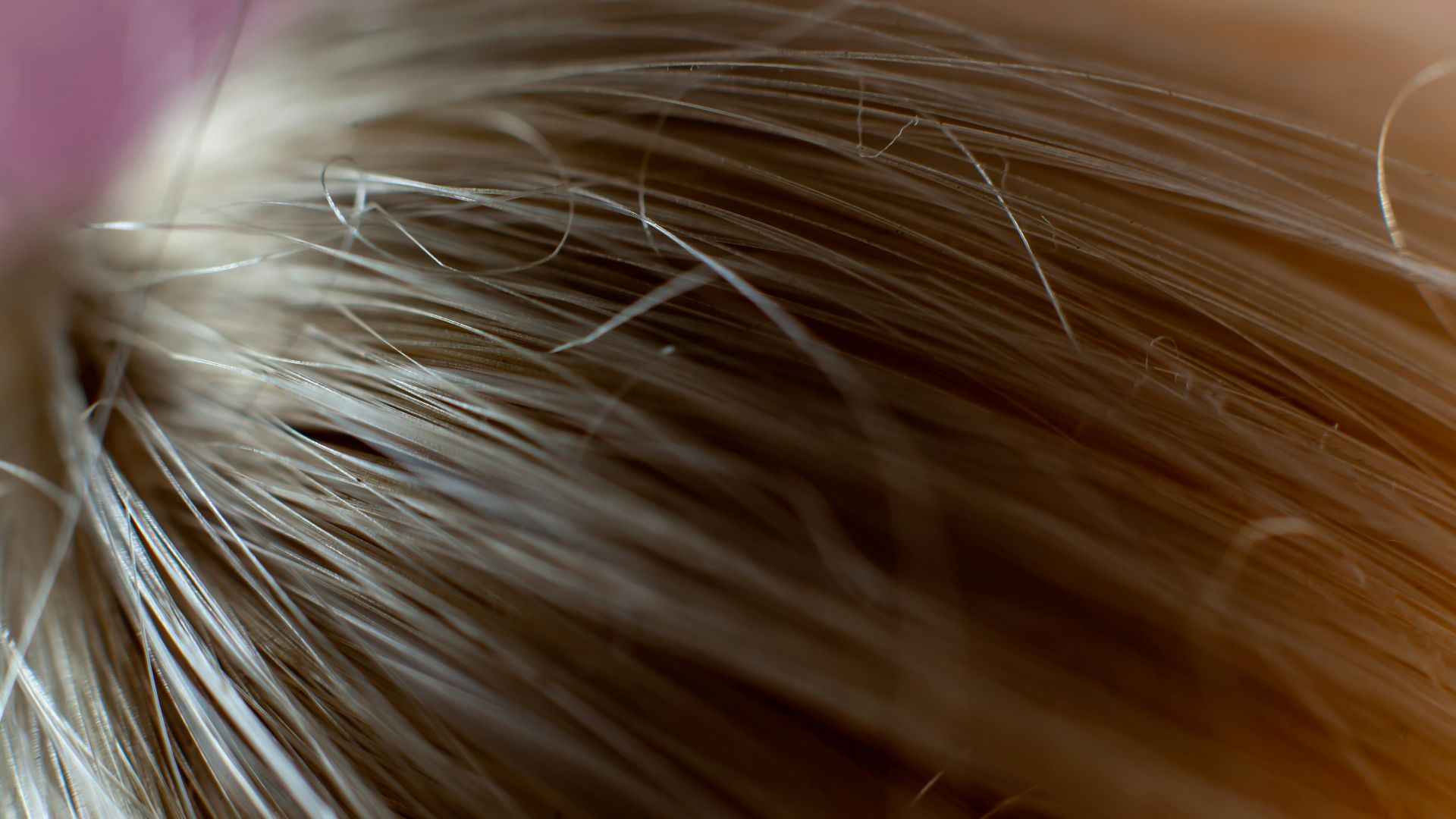 4. Cheveux cassants
