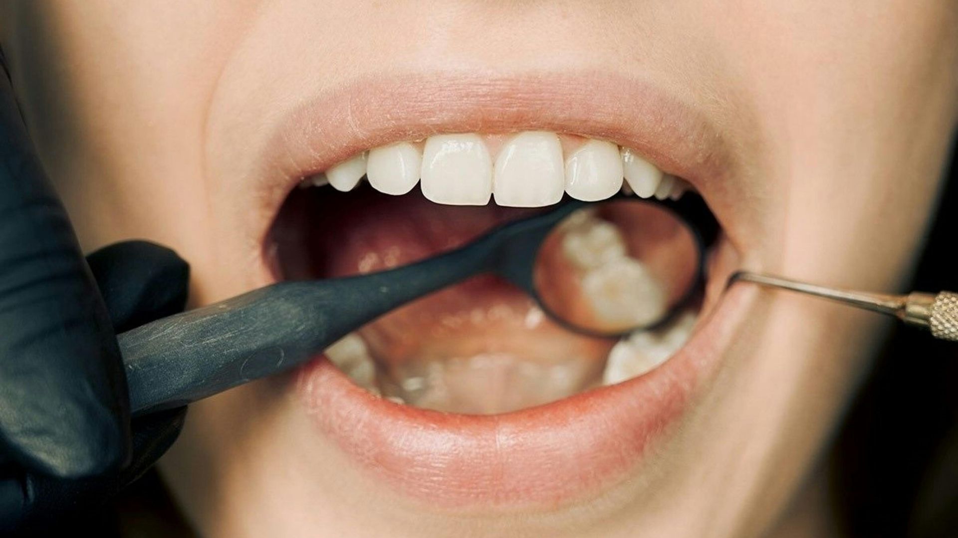 4. Vos gencives saignent plus facilement