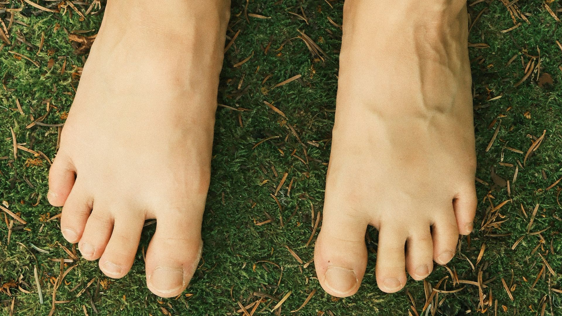 7. Gonflement des pieds ou des jambes