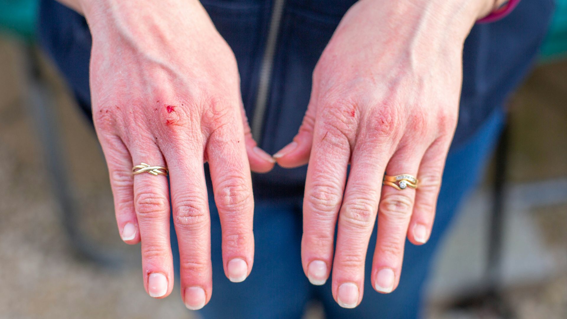 6. Votre peau vous démange davantage