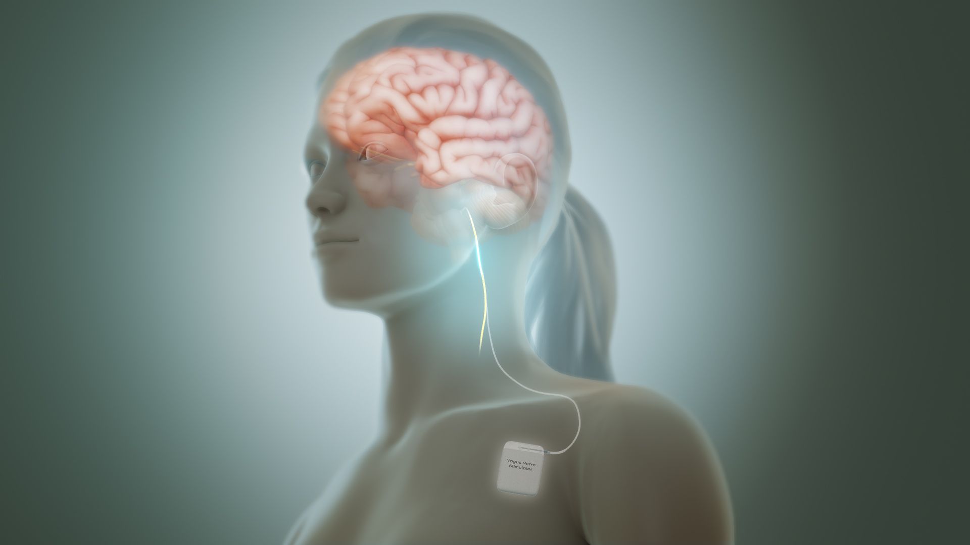 20. Dispositifs de stimulation du nerf vague