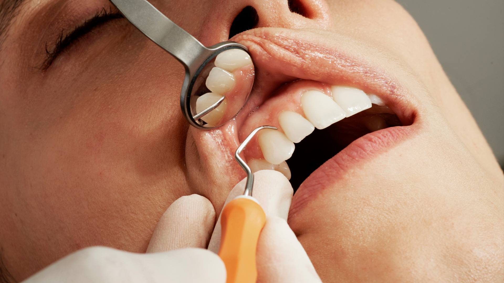 2. Soins dentaires préventifs