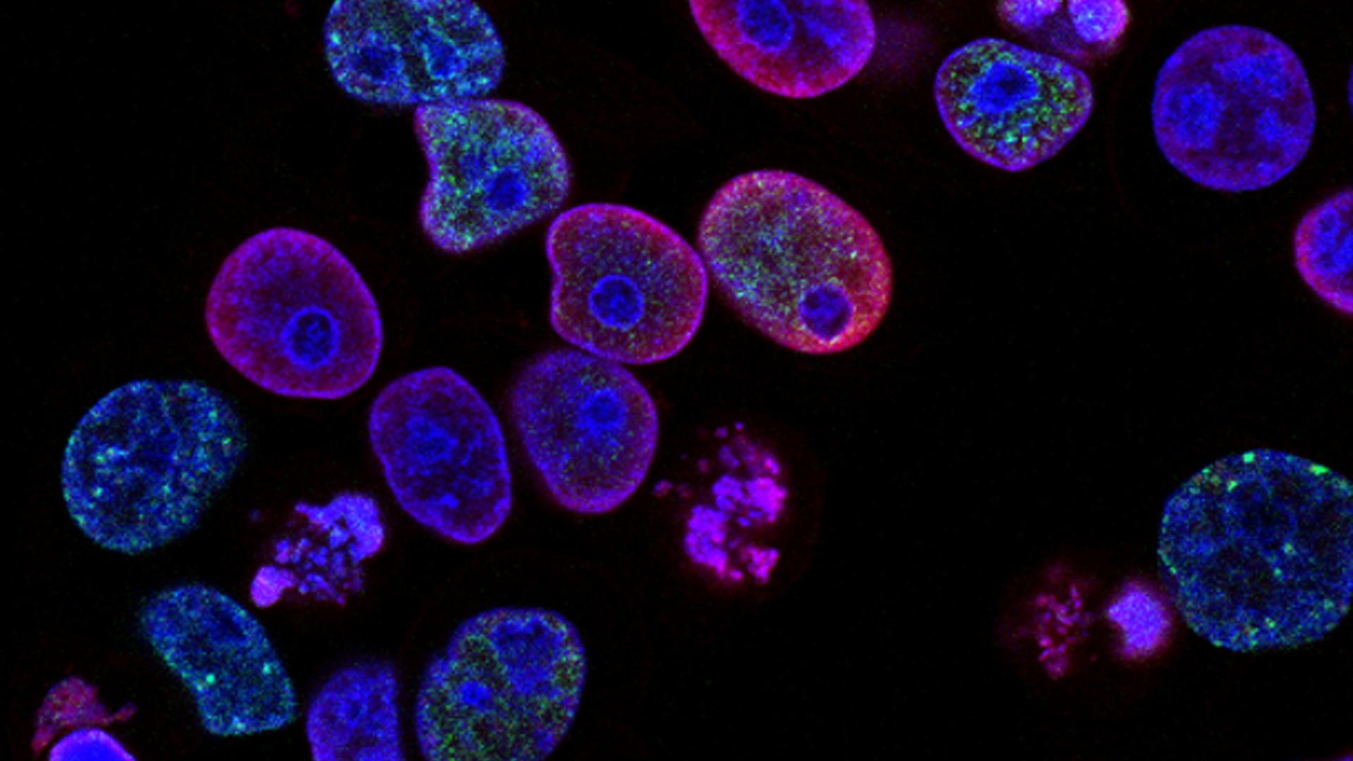 4. L'inflammation élimine les cellules endommagées