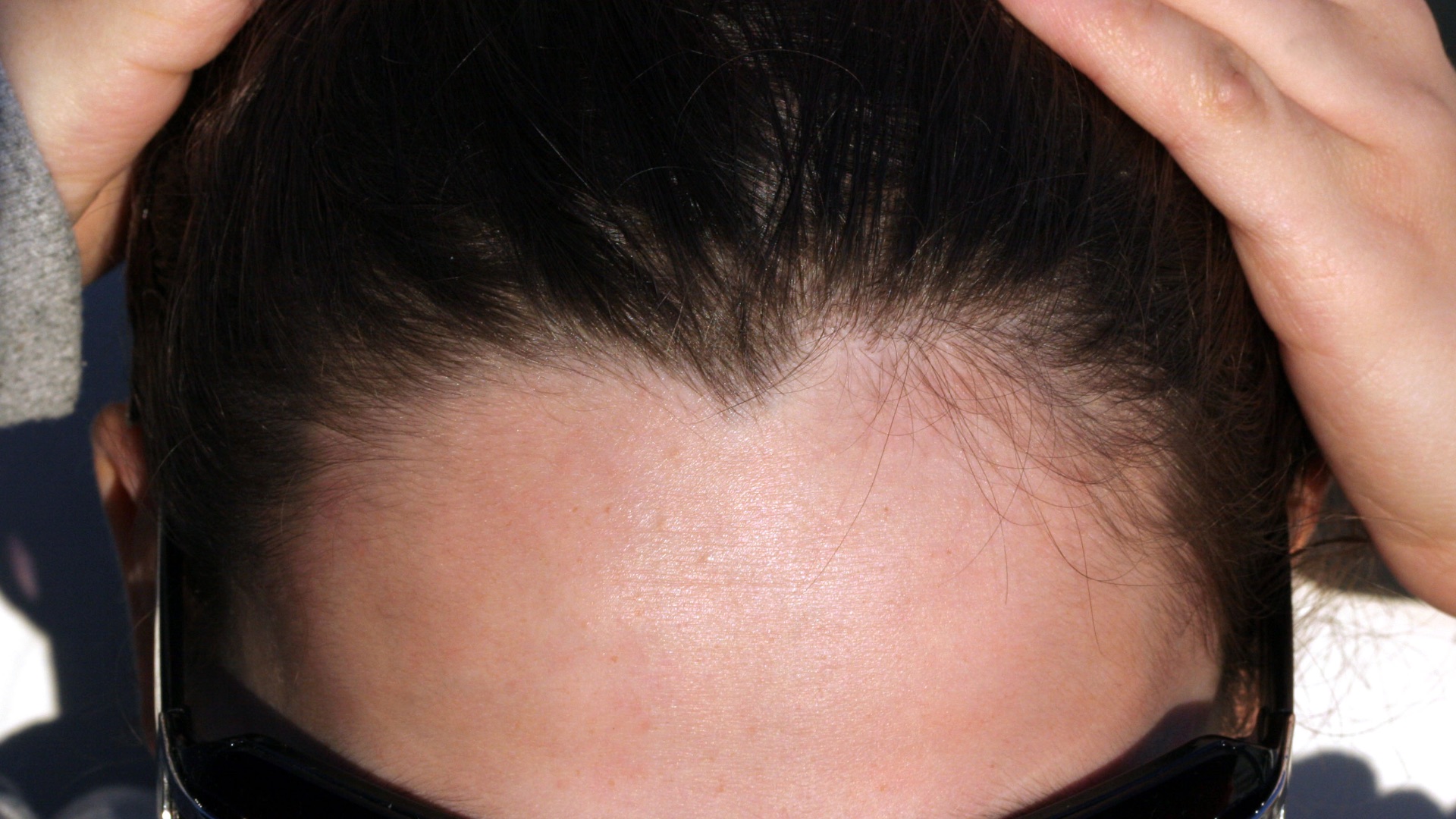 3. La ligne des cheveux en V