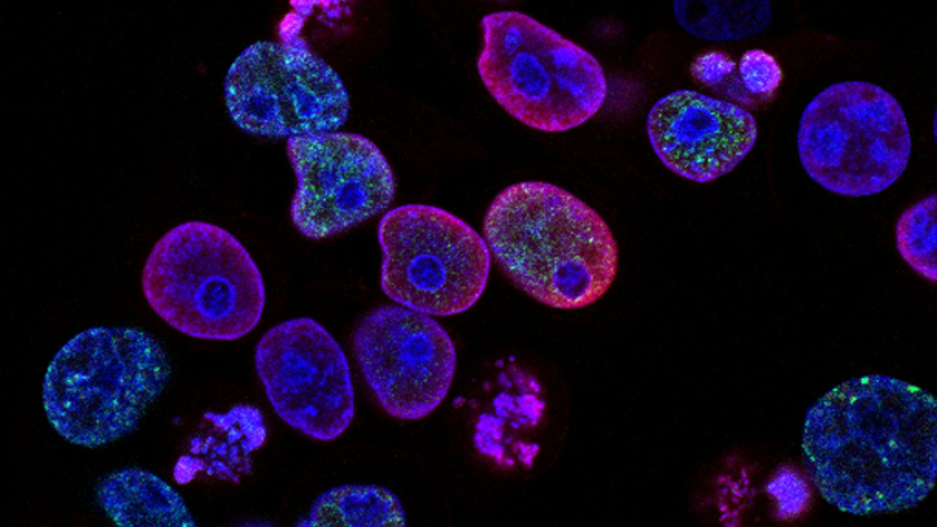 16. L'étude de Jon Sudbø sur la prévention du cancer