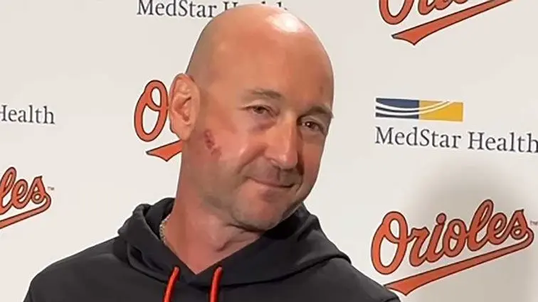 Seven fractures in his cheekbone and a broken jaw: the Orioles’ manager had a narrow escape