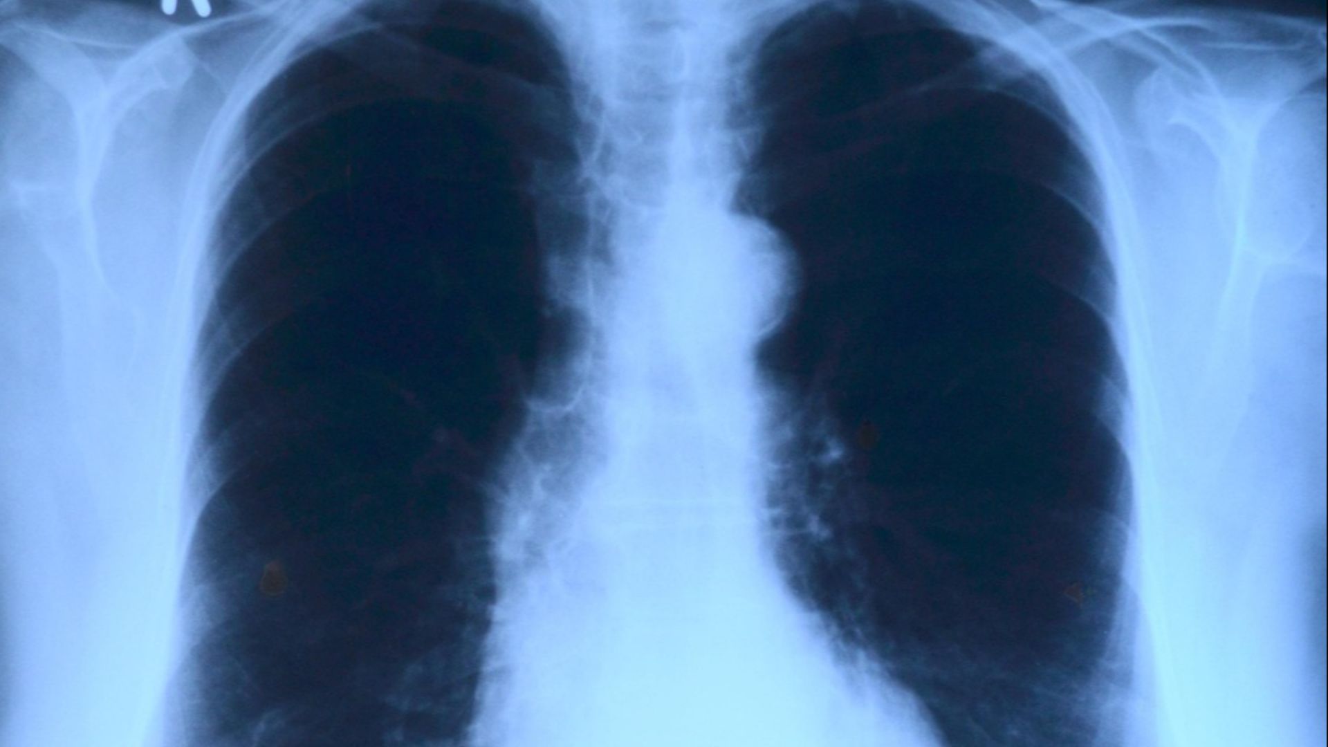 6. La découverte des rayons X