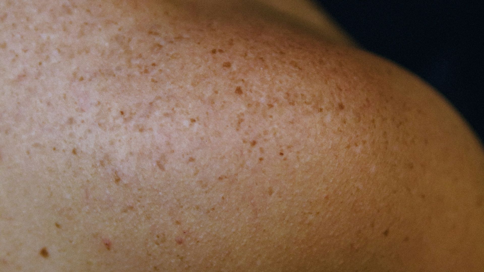 11. Examen de la peau
