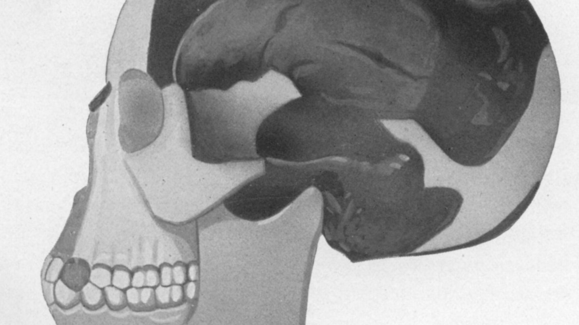 5. L'homme de Piltdown