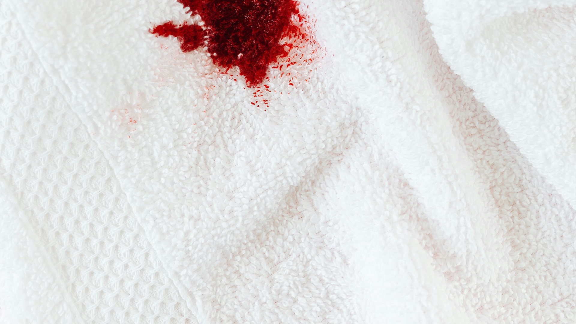 4. Vêtements tachés