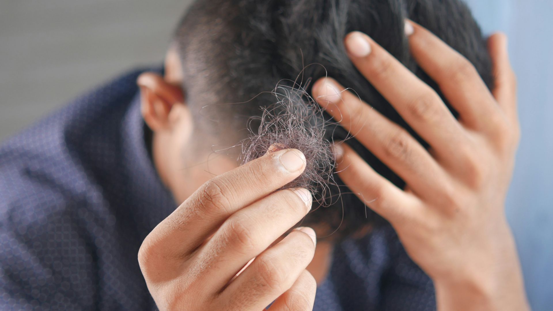 10. Prendre la perte soudaine de cheveux à la légère