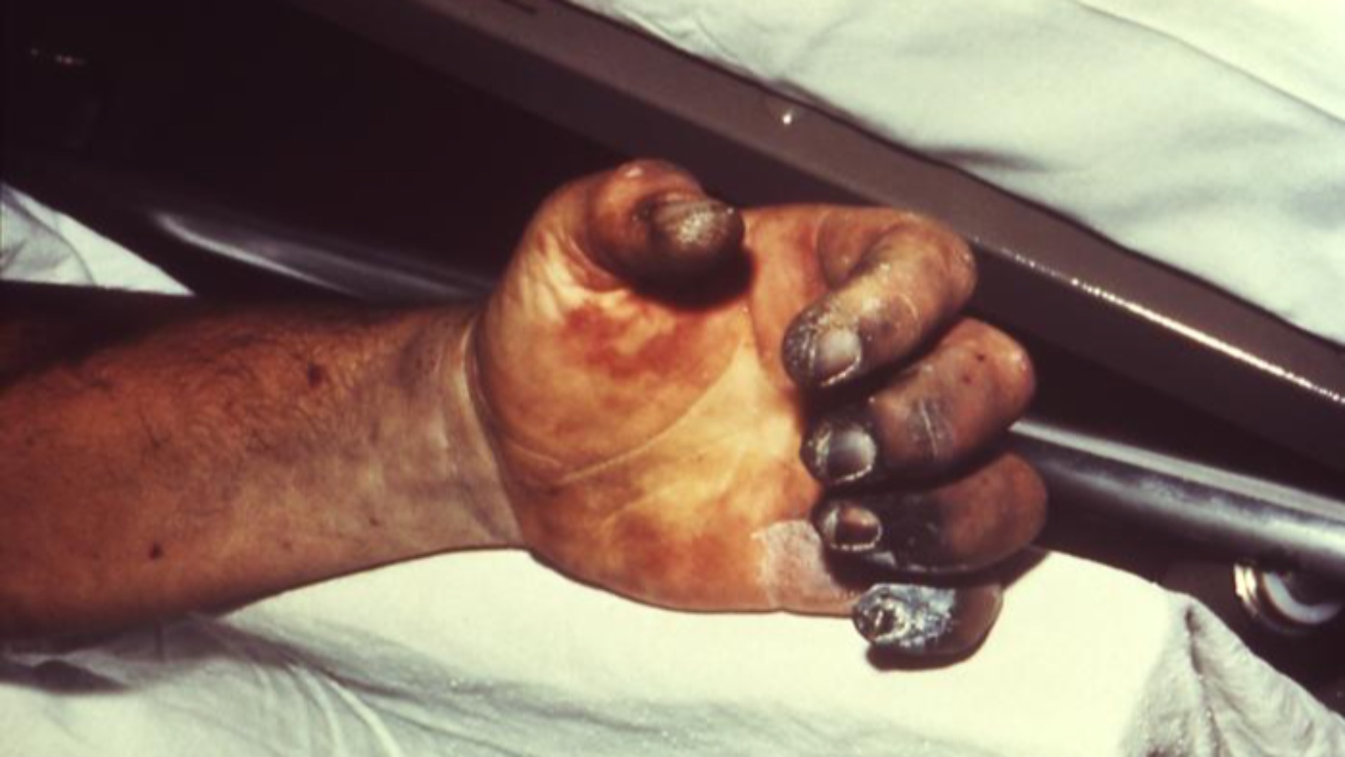 7. L'origine probable de la peste noire a été retracée