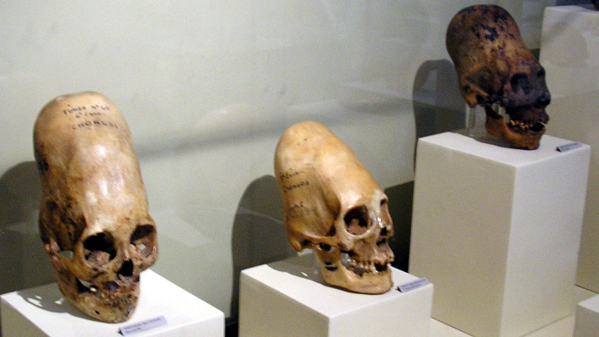 16. Les crânes de Paracas