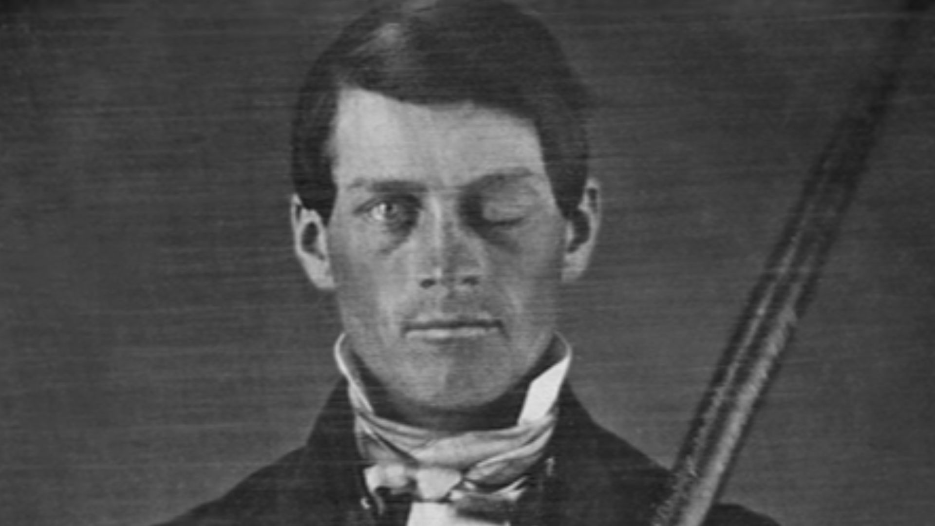 Phineas Gage