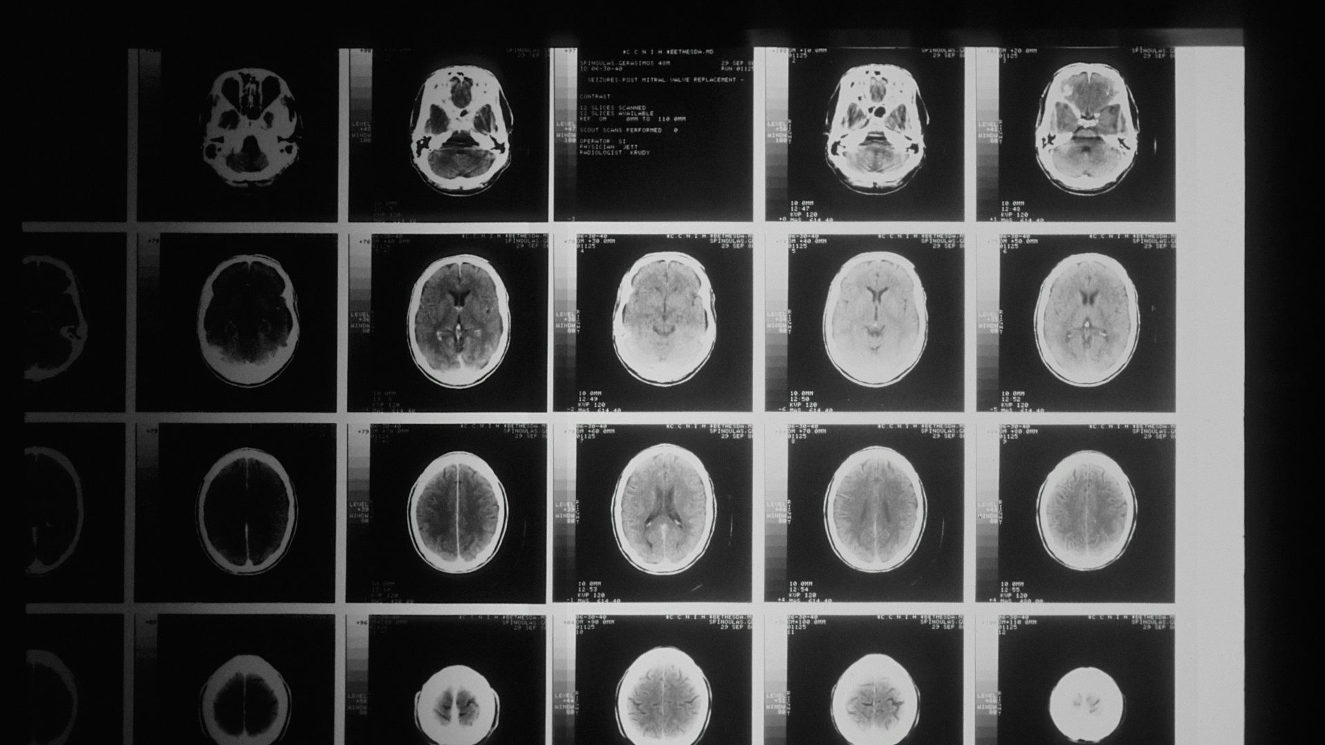 9. L'imagerie médicale : un progrès pour le diagnostic et le traitement