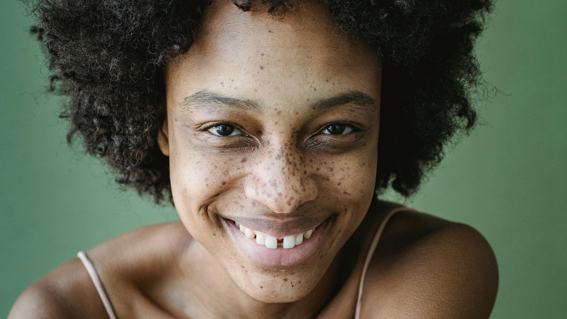 10 « défauts » physiques que les gens trouvent en réalité attirants et 10 façons d’assumer vos traits naturels