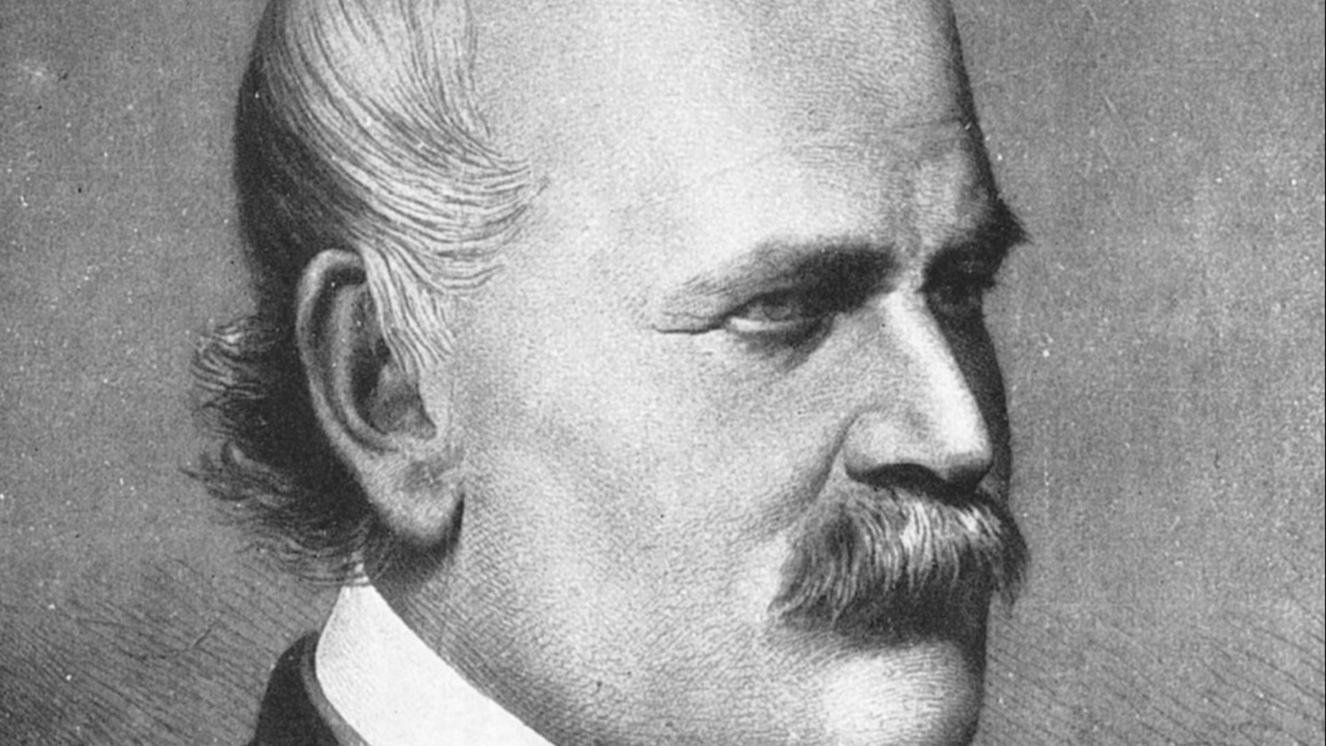 1. Ignaz Semmelweis