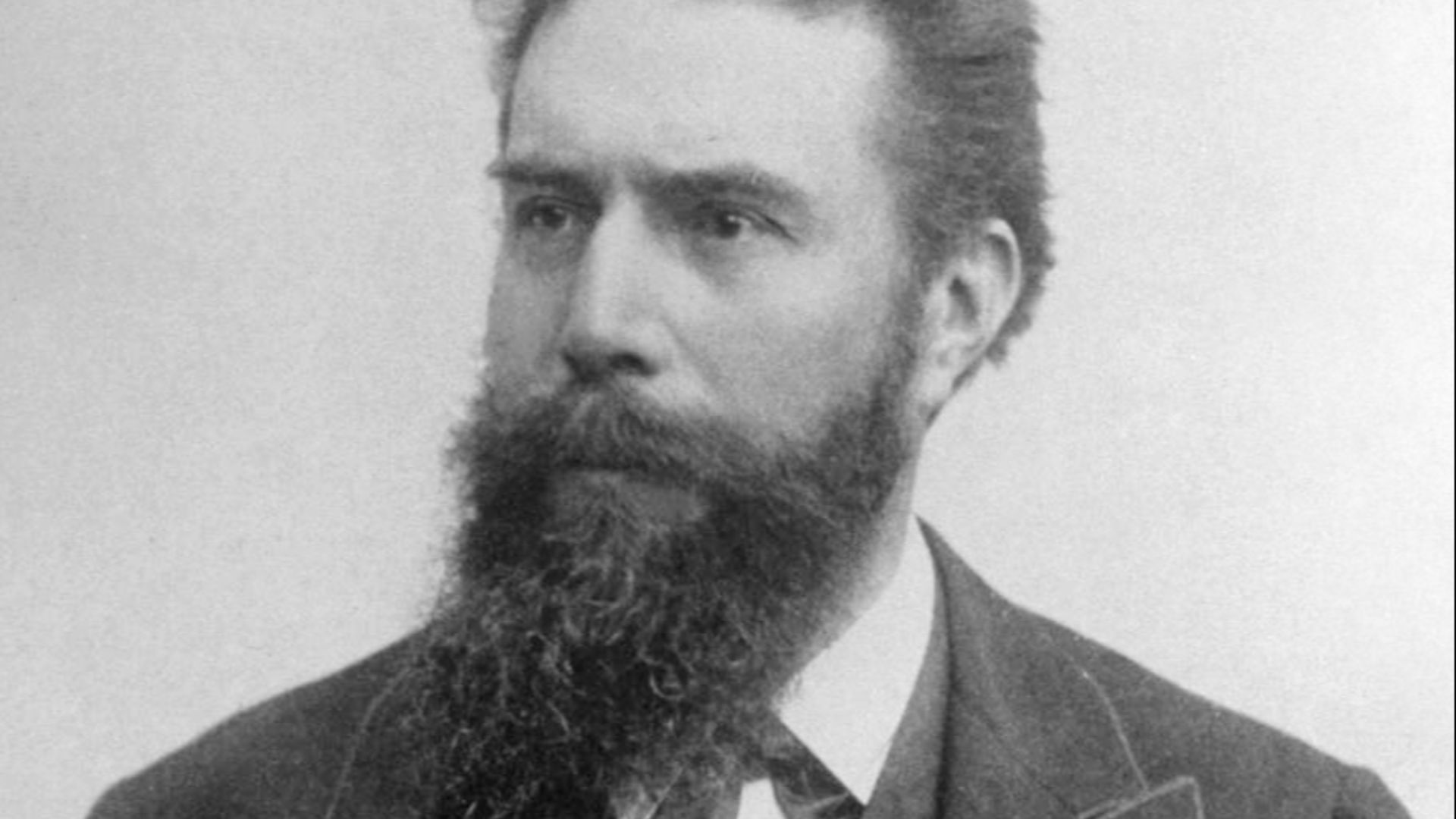 9. La première radiographie