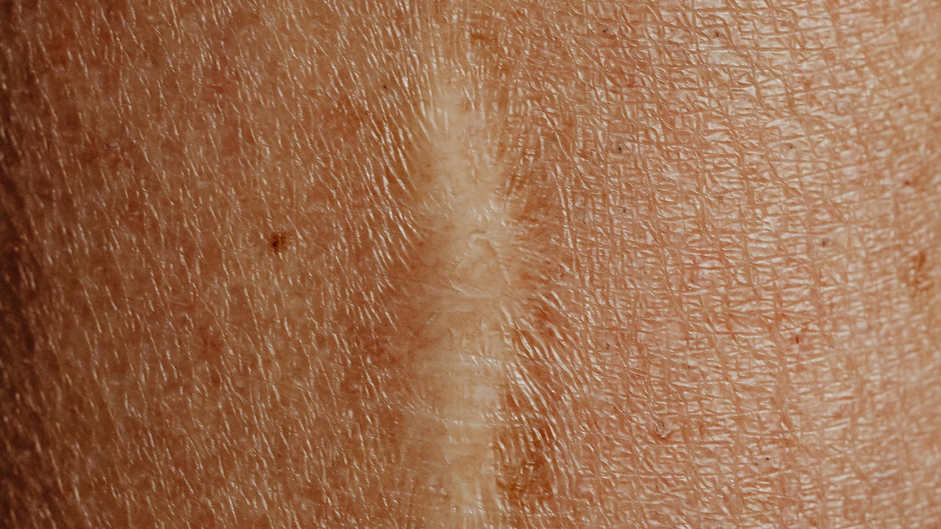 9. Cicatrices