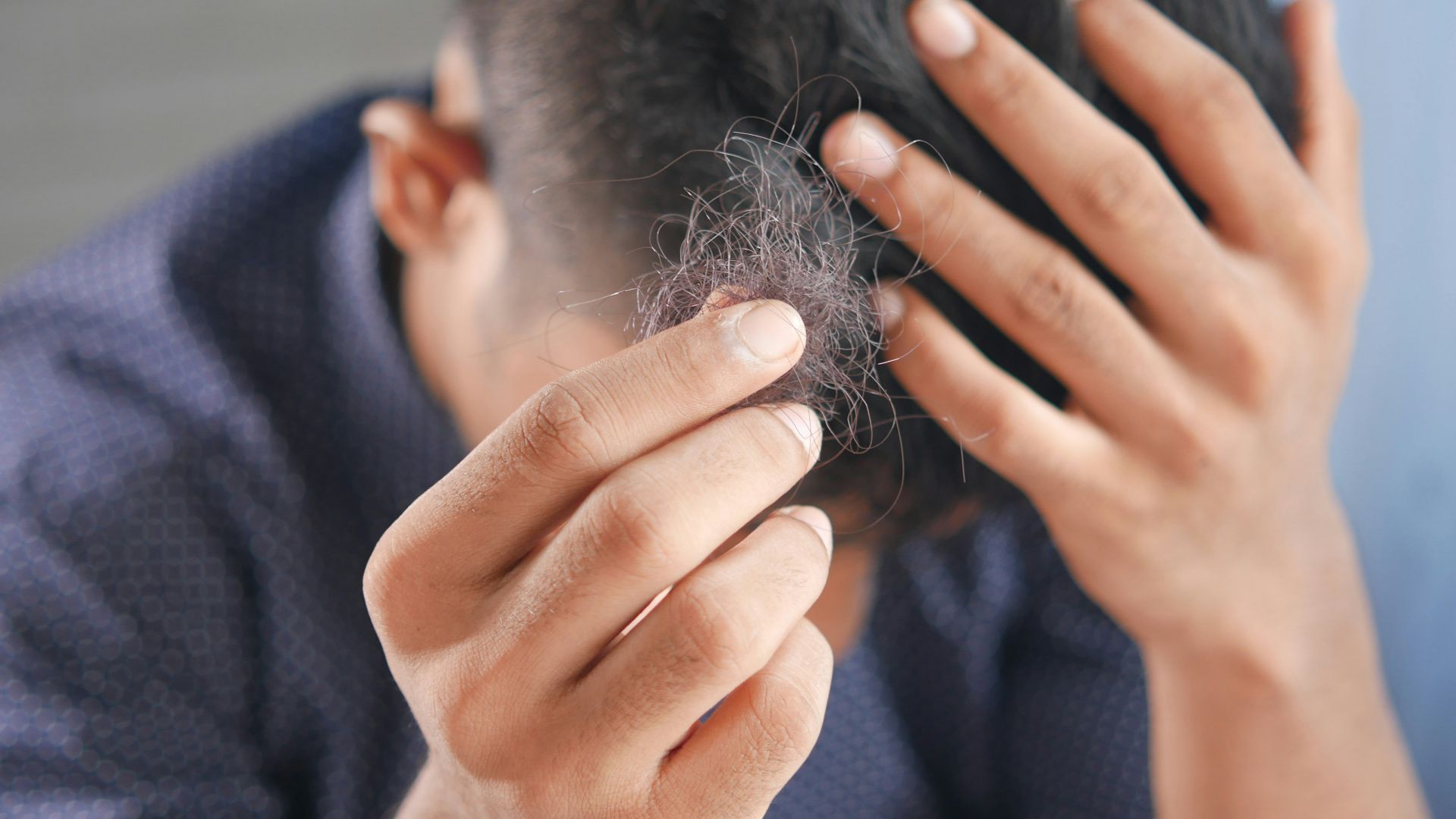 13. Vous avez l'impression que vos cheveux tombent davantage