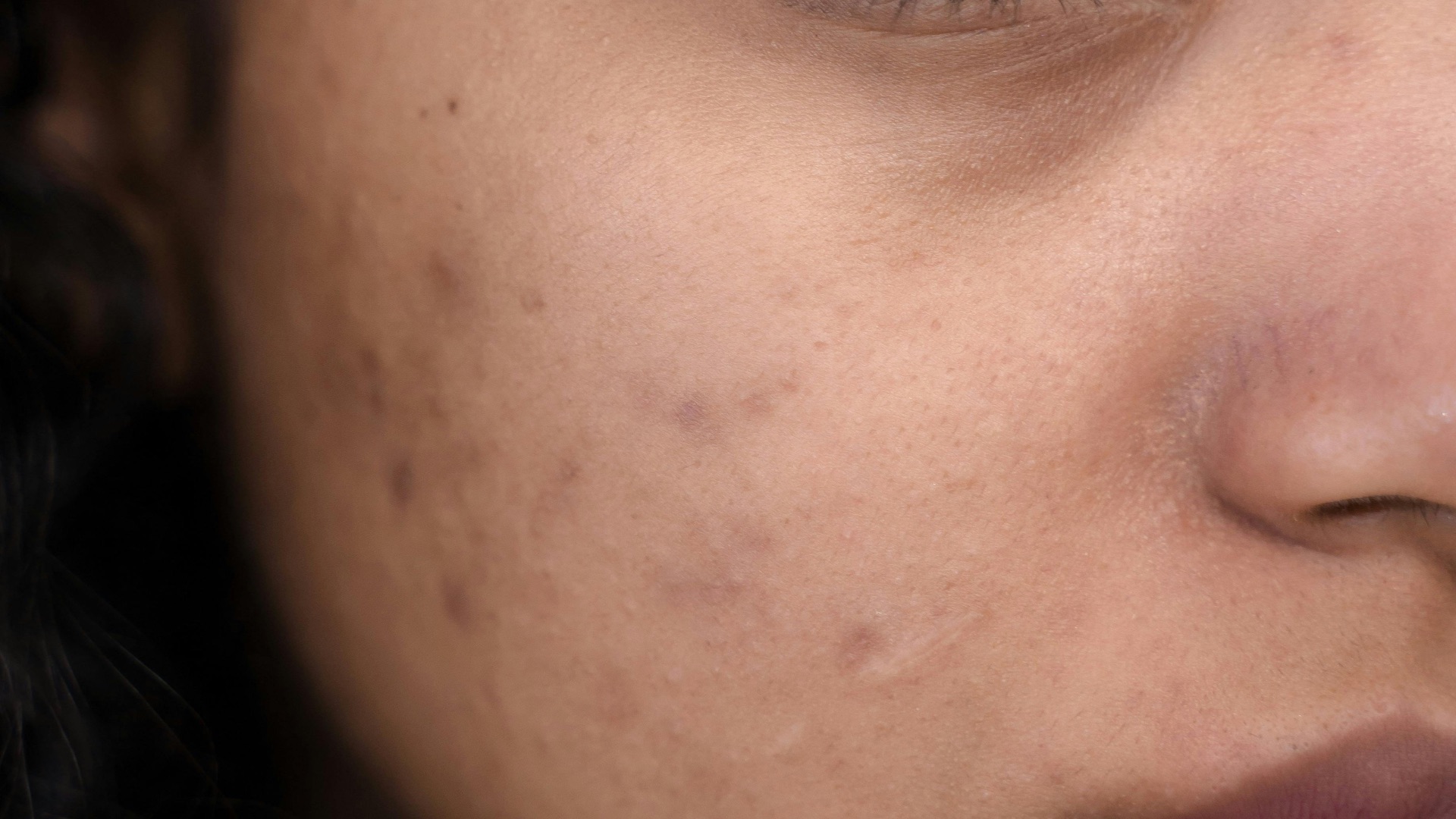3. Votre peau semble terne et sans éclat