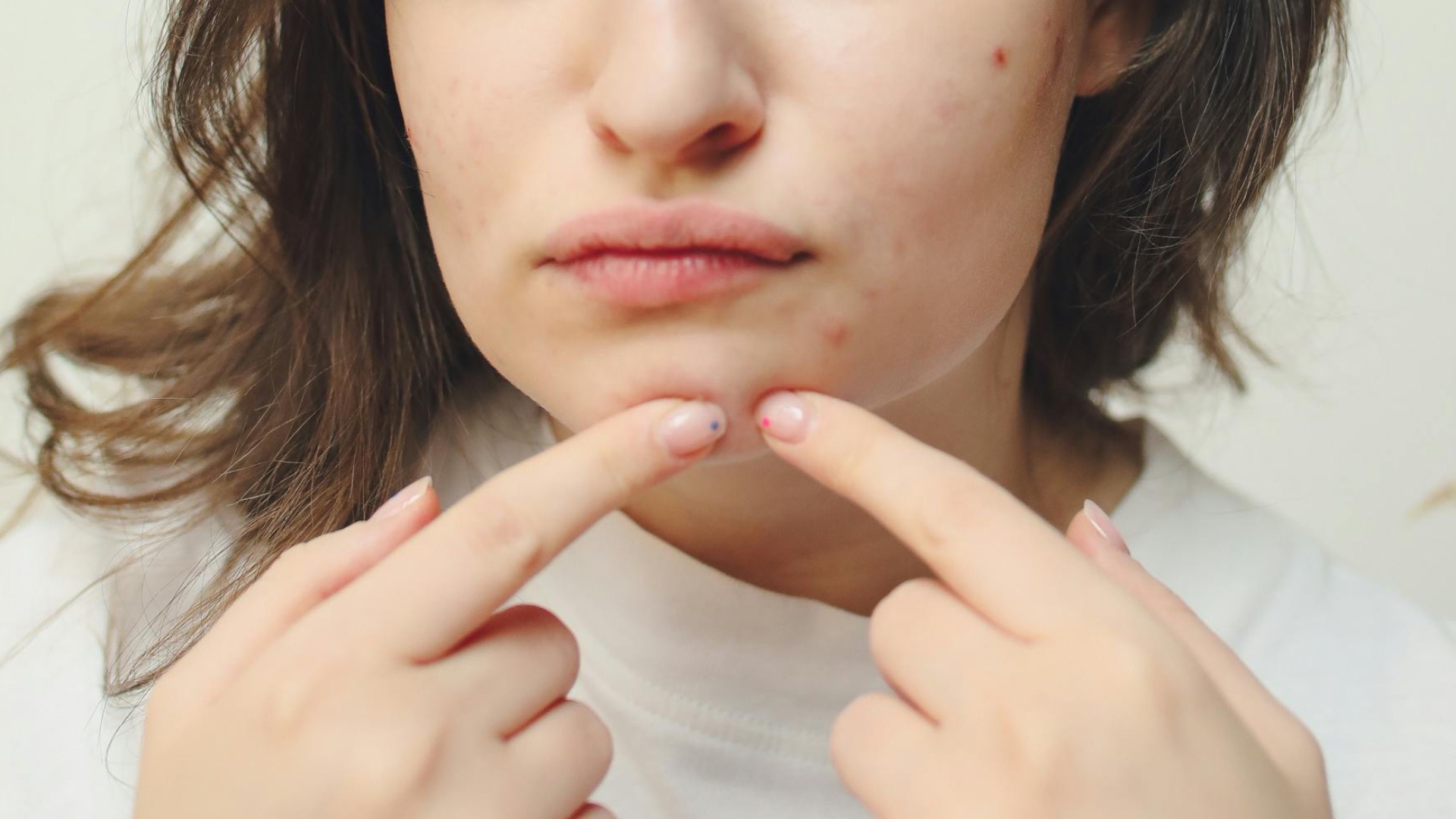2. Vous avez plus d'imperfections que d'habitude
