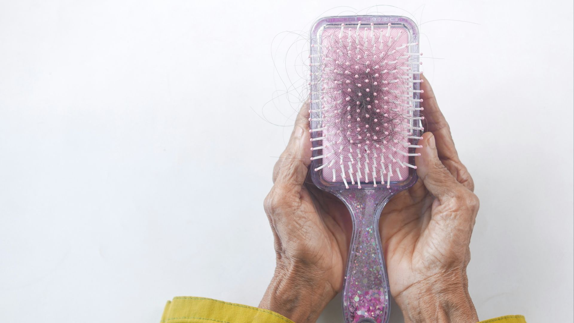 8. Une perte de cheveux qu'on ne prend pas au sérieux