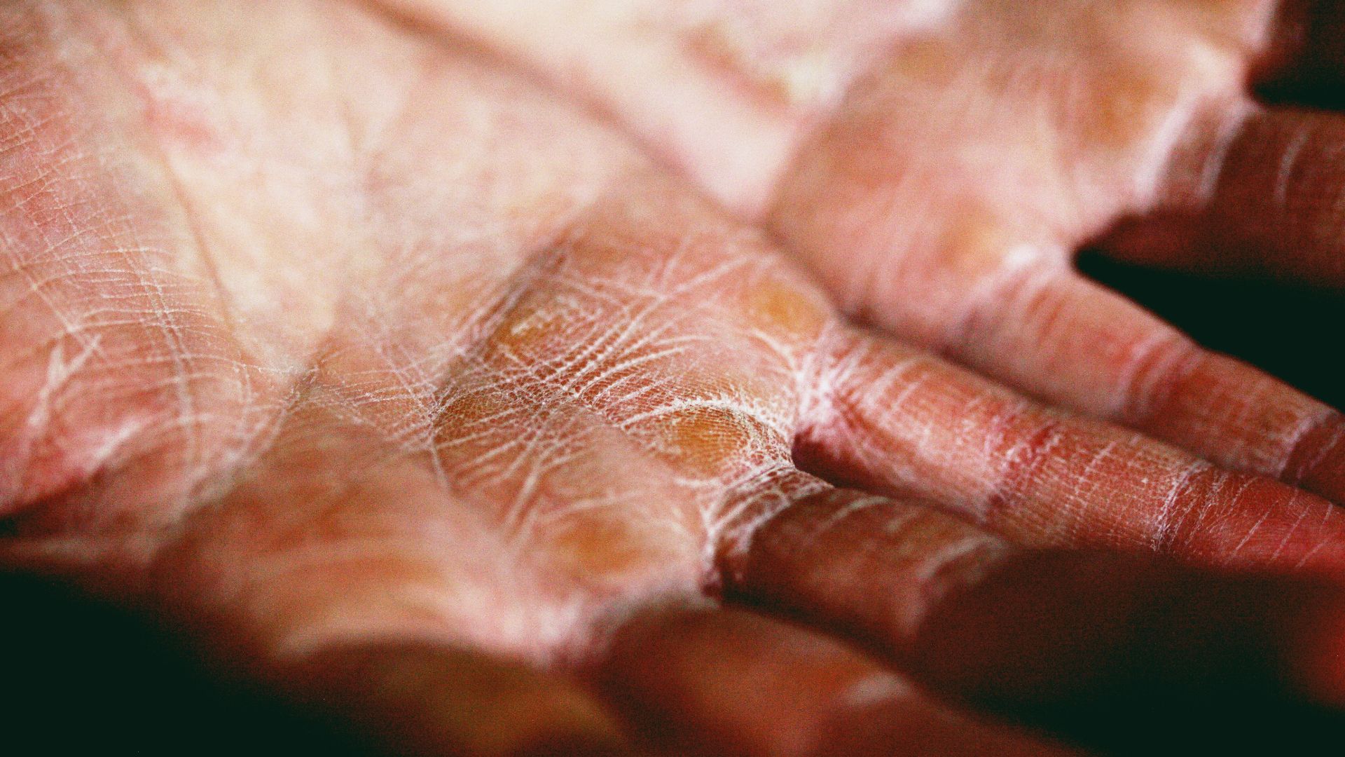 14. Votre peau est sèche ou froide au toucher