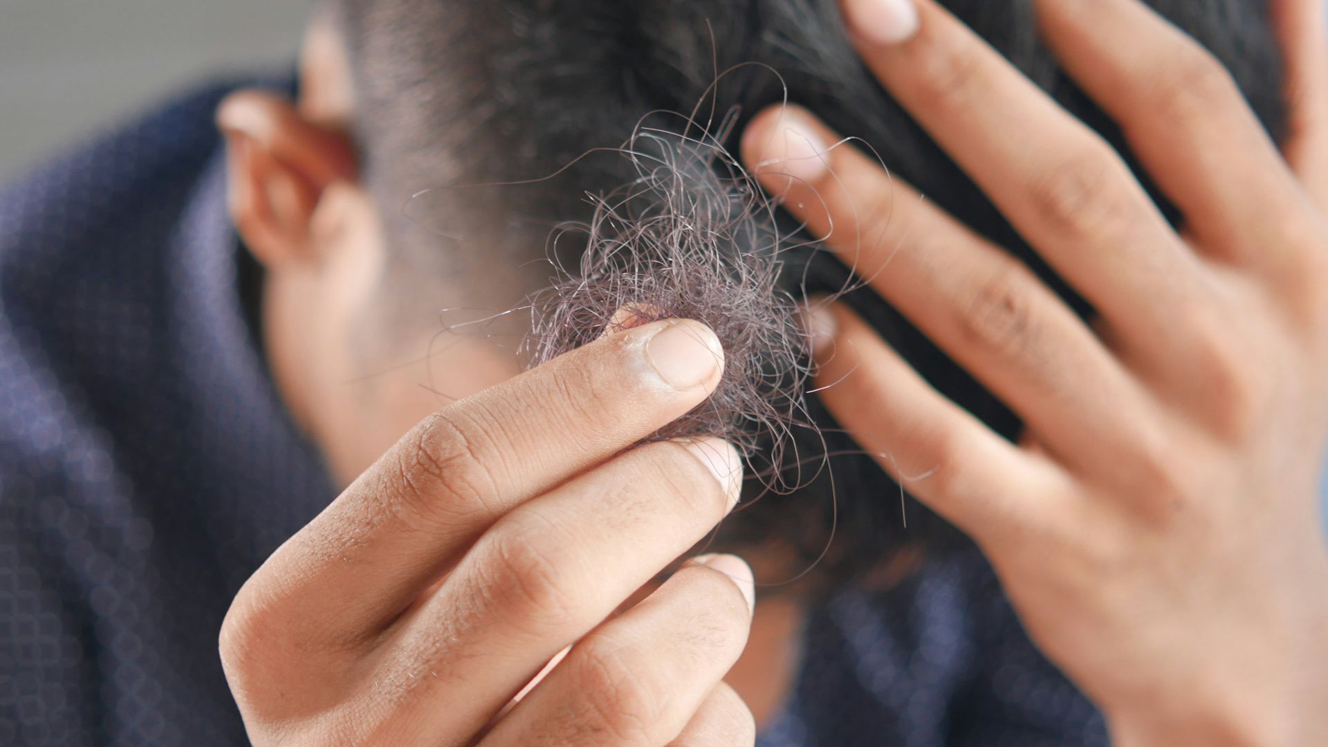 3. Les cheveux semblent plus clairsemés