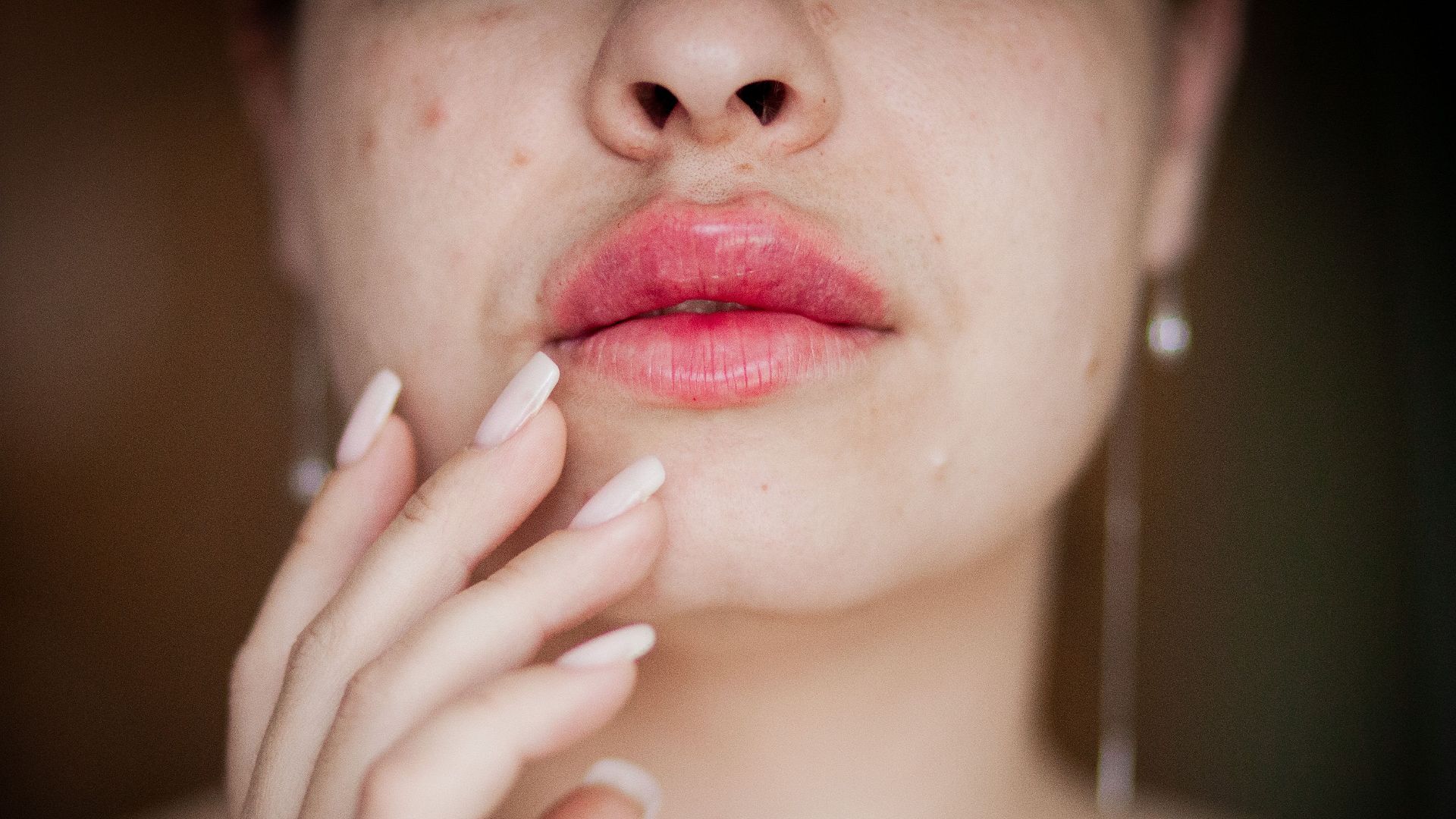 5. Infection