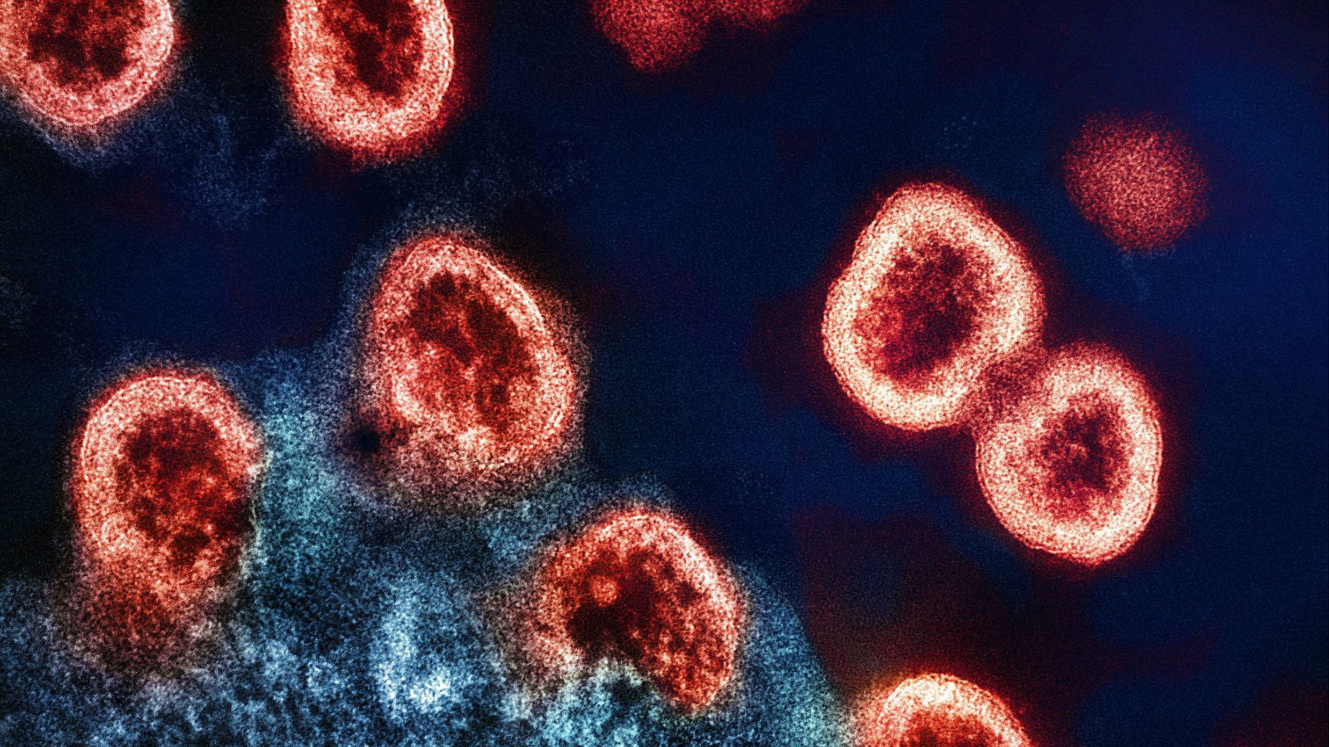 6. Renforcer votre système immunitaire