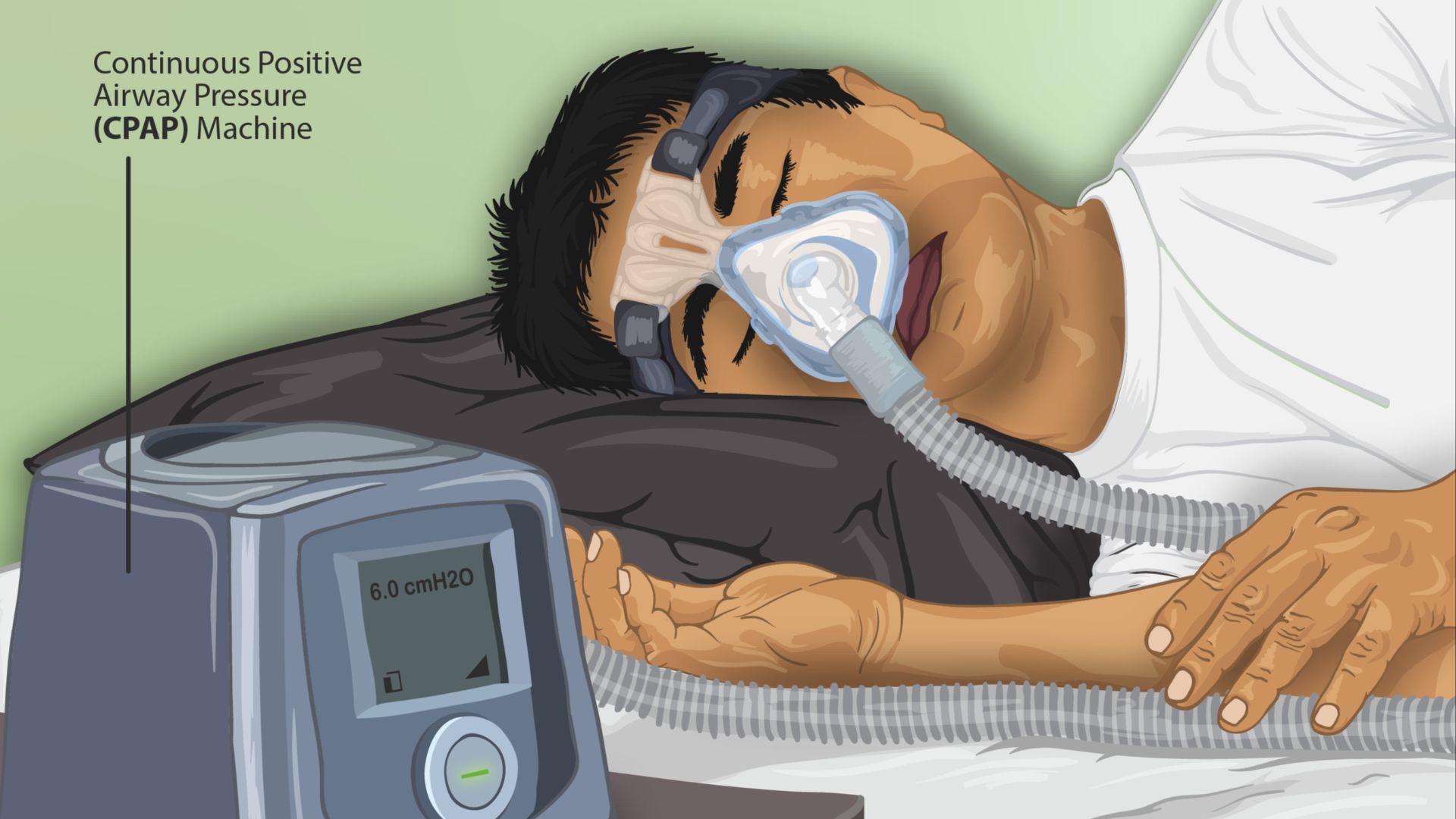 12. L'apnée du sommeil pourrait perturber votre sommeil