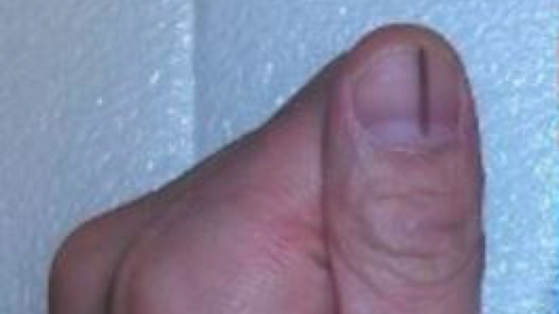 9. Une strie sombre sur l'ongle