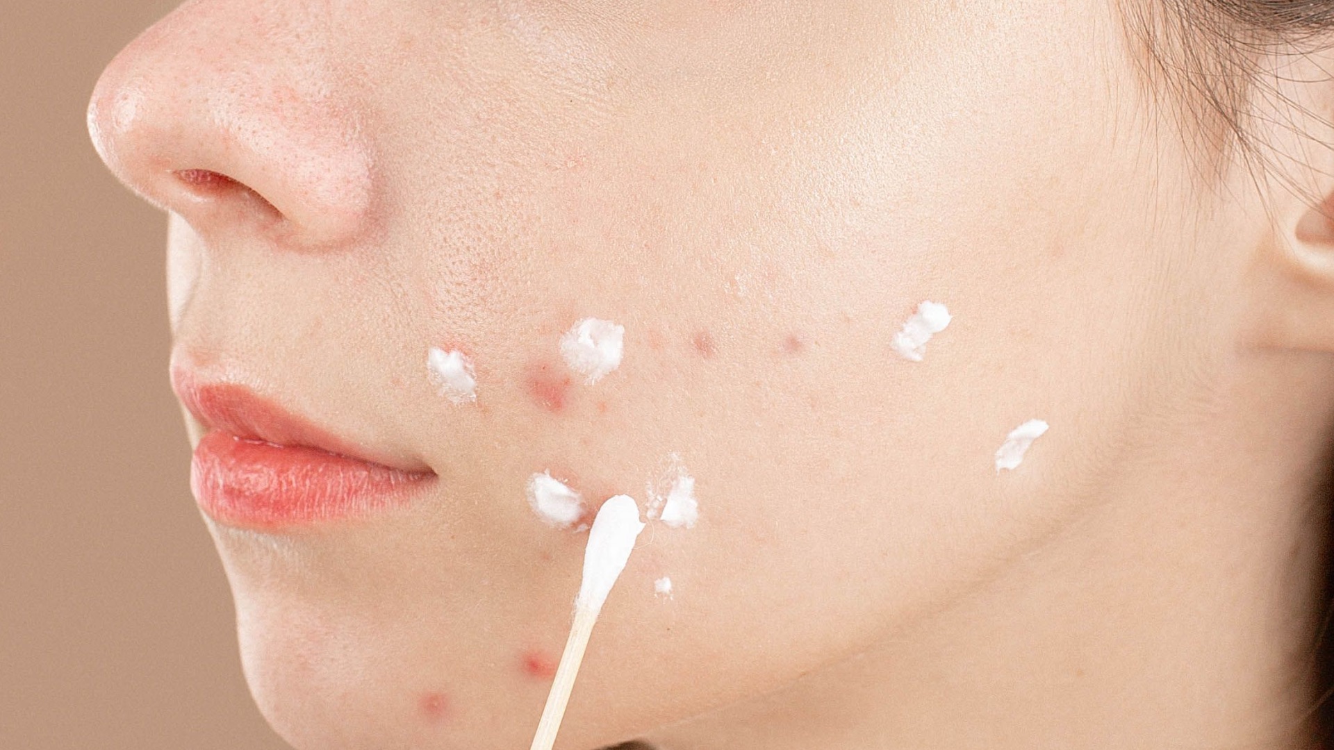 2. Lorsque vous avez tendance à avoir des boutons