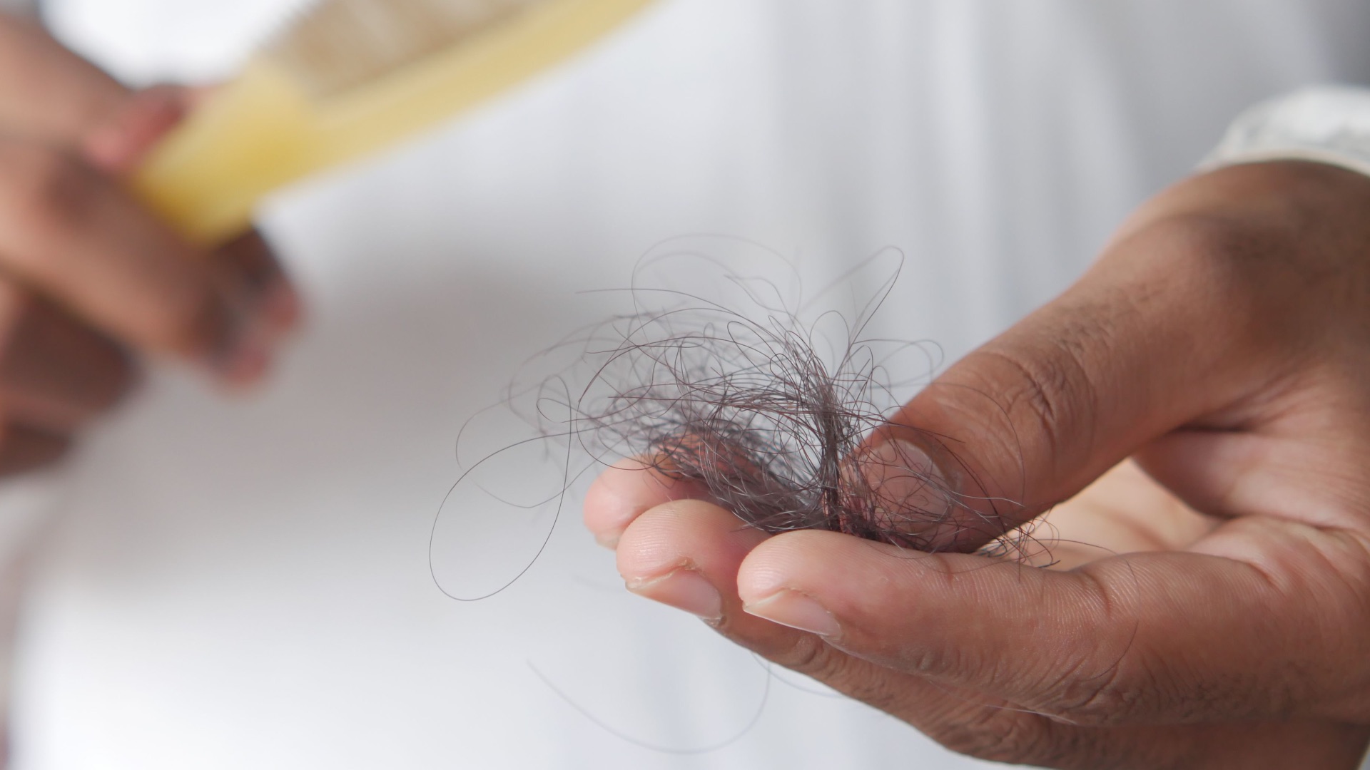 8. Perte de cheveux par plaques
