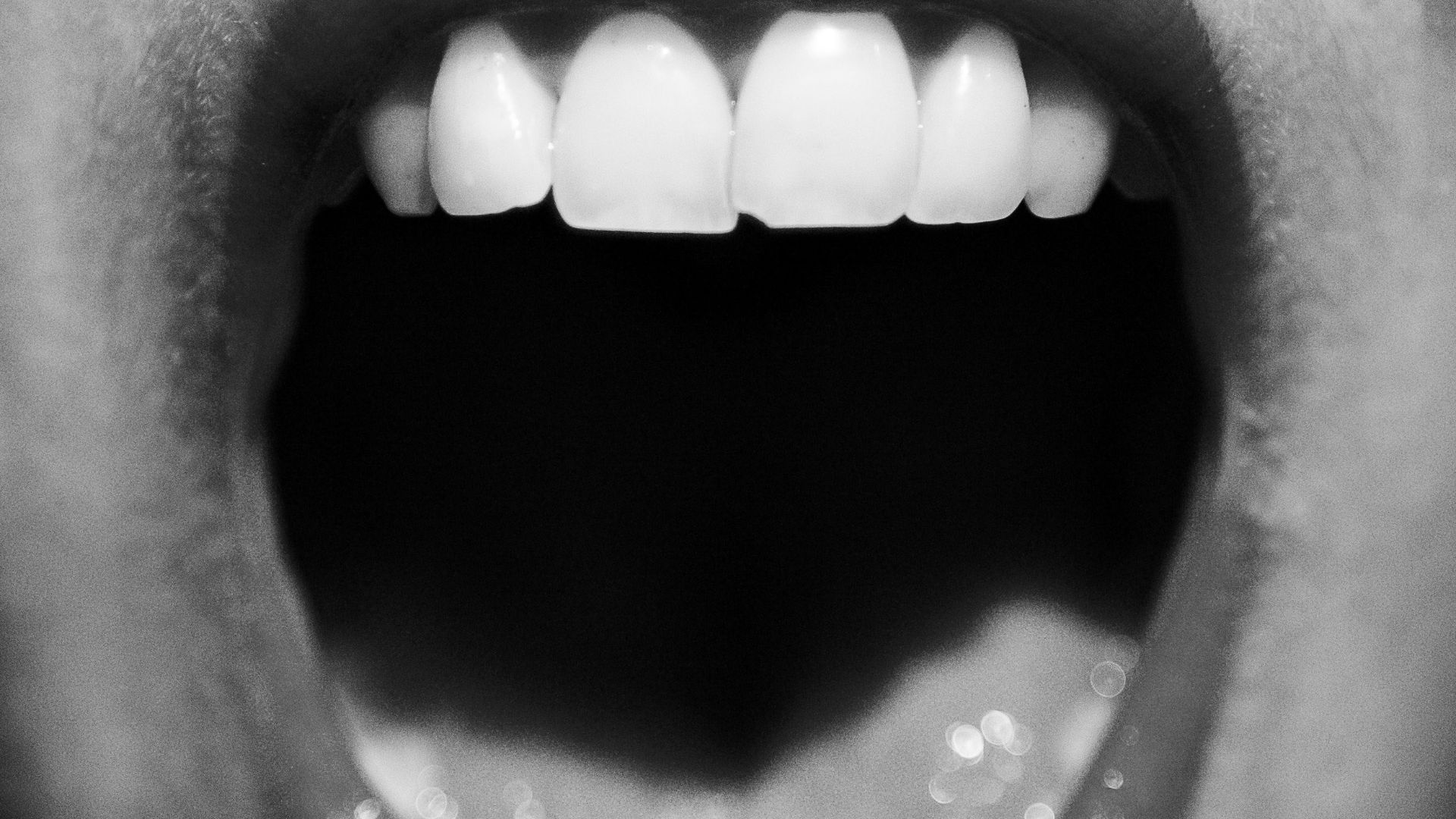 3. Vous avez la bouche sèche